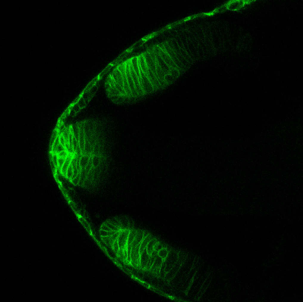 Tg(-8.0cldnb:lynGFP)zf106 24hpf dorsal horizontal section through the telencephalon