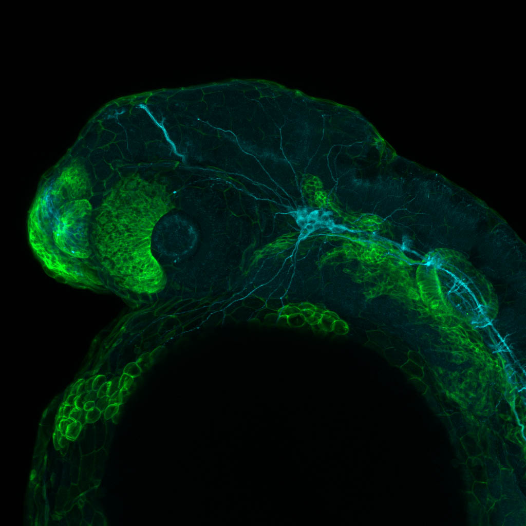 Tg(-8.0cldnb:lynGFP)zf106 24hpf lateral with and acetylated tubulin(cyan).