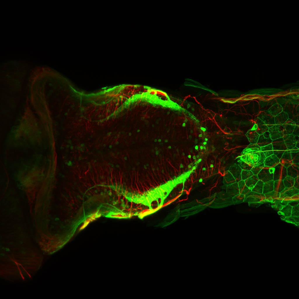 Tg(-8.0cldnb:lynGFP)zf106 5dpf dorsal with acetylated tubulin(red). 