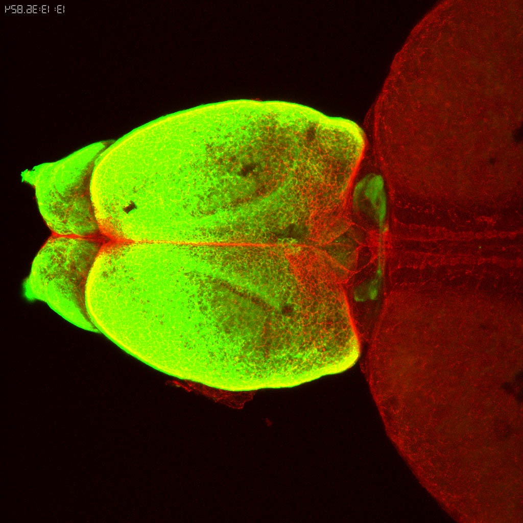 Tg(-8.0cldnb:lynGFP)zf106  adult dorsal with zo1(red) 