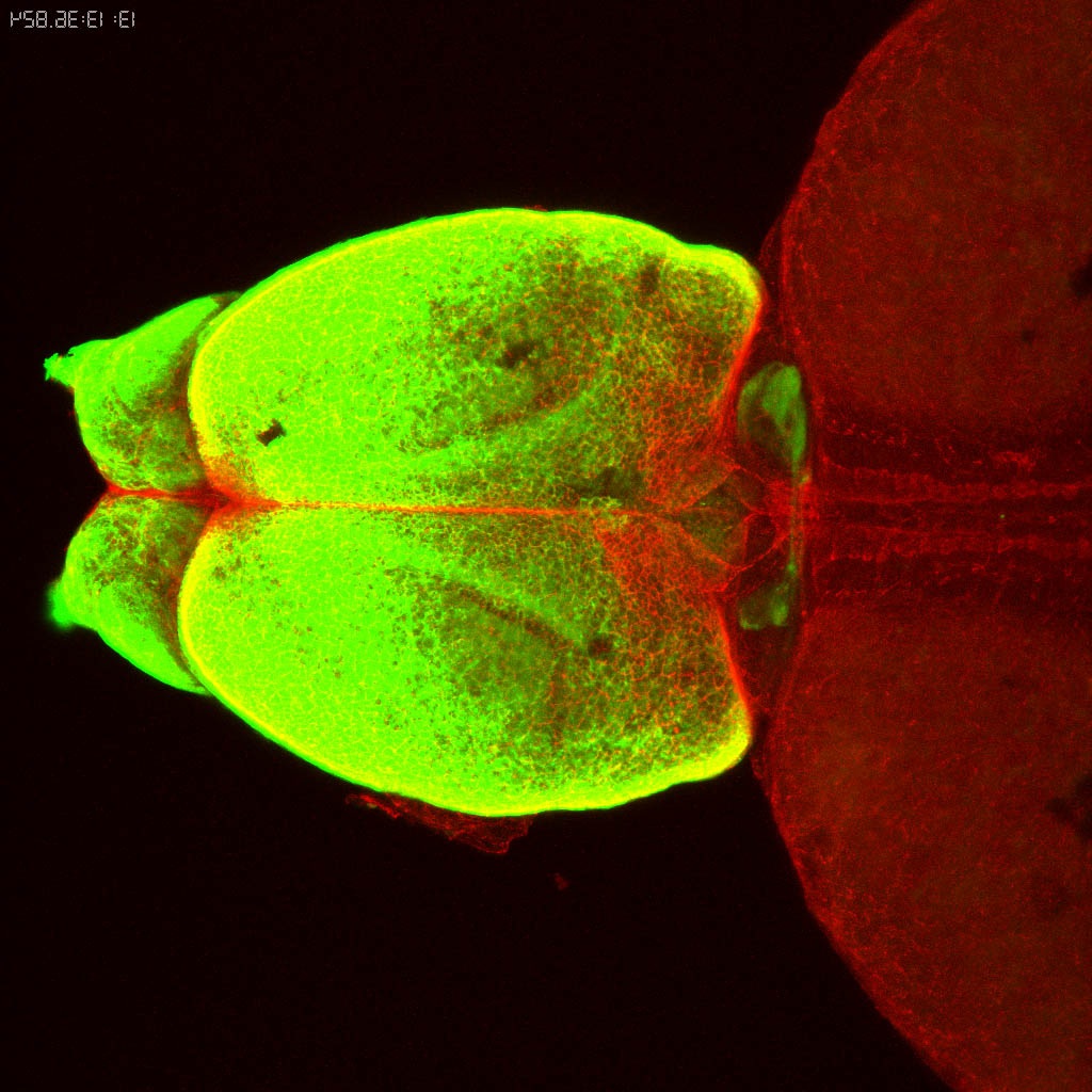 Tg(-8.0cldnb:lynGFP)zf106 adult dorsal with zo1(red)