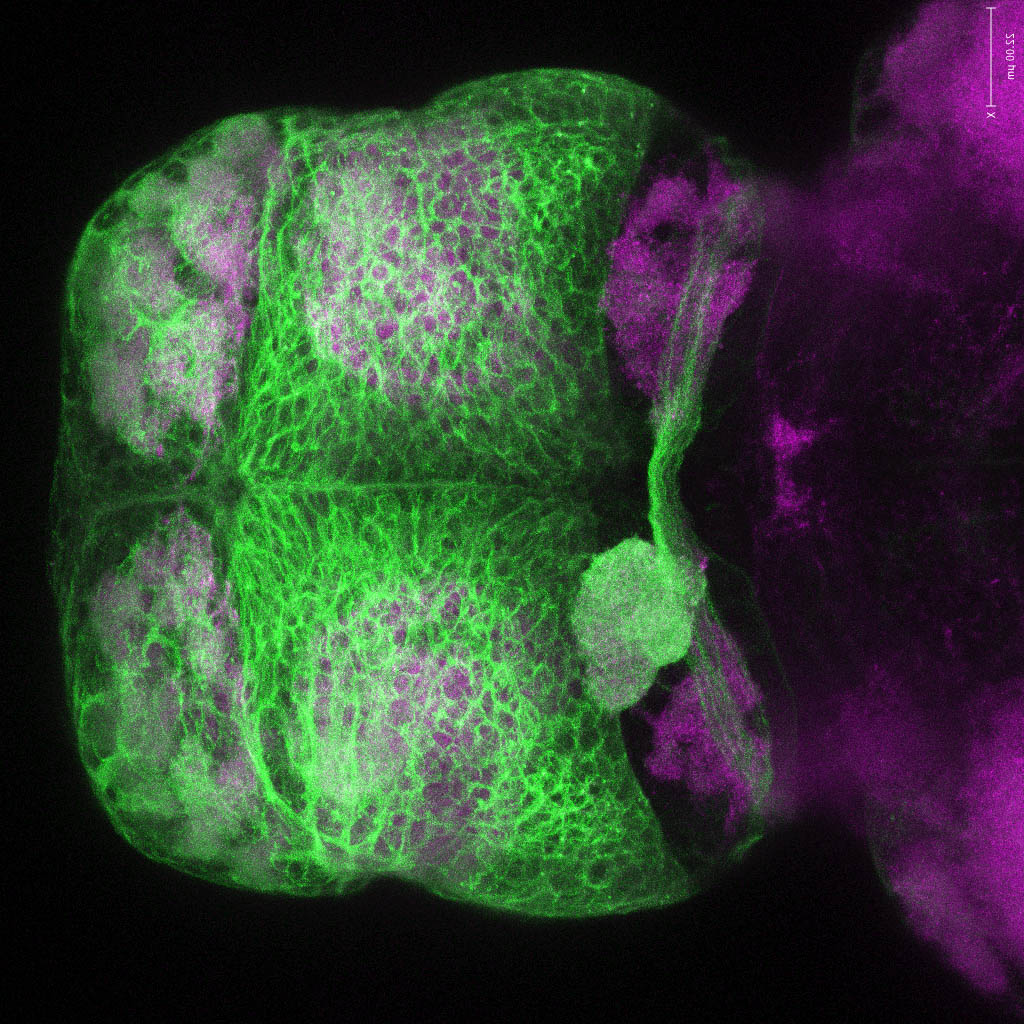 Tg(-8.0cldnb:lynGFP)zf106 dorsal 4dpf