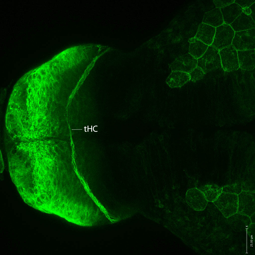 Tg(-8.0cldnb:lynGFP)zf106 dorsal 48hpf 