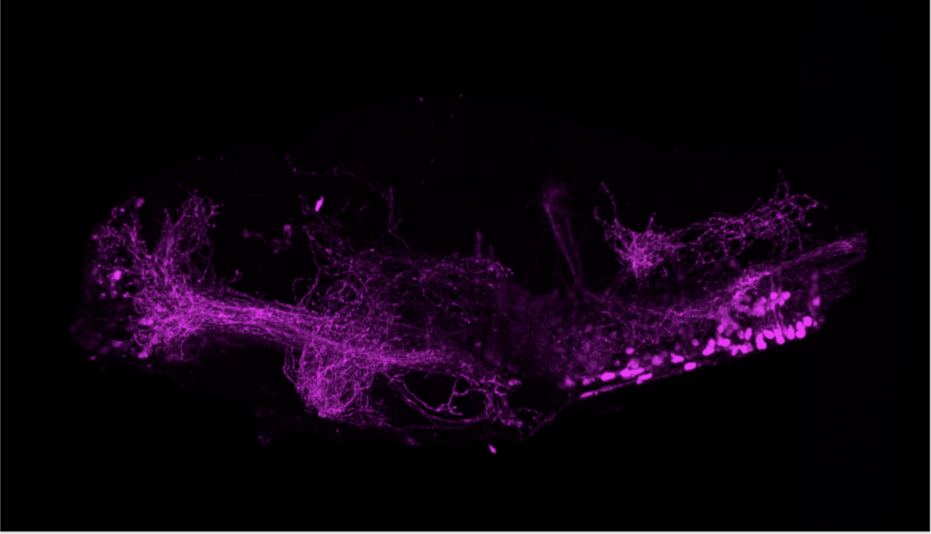 Tg(Pet1:KalTA4) 4dpf lateral view.