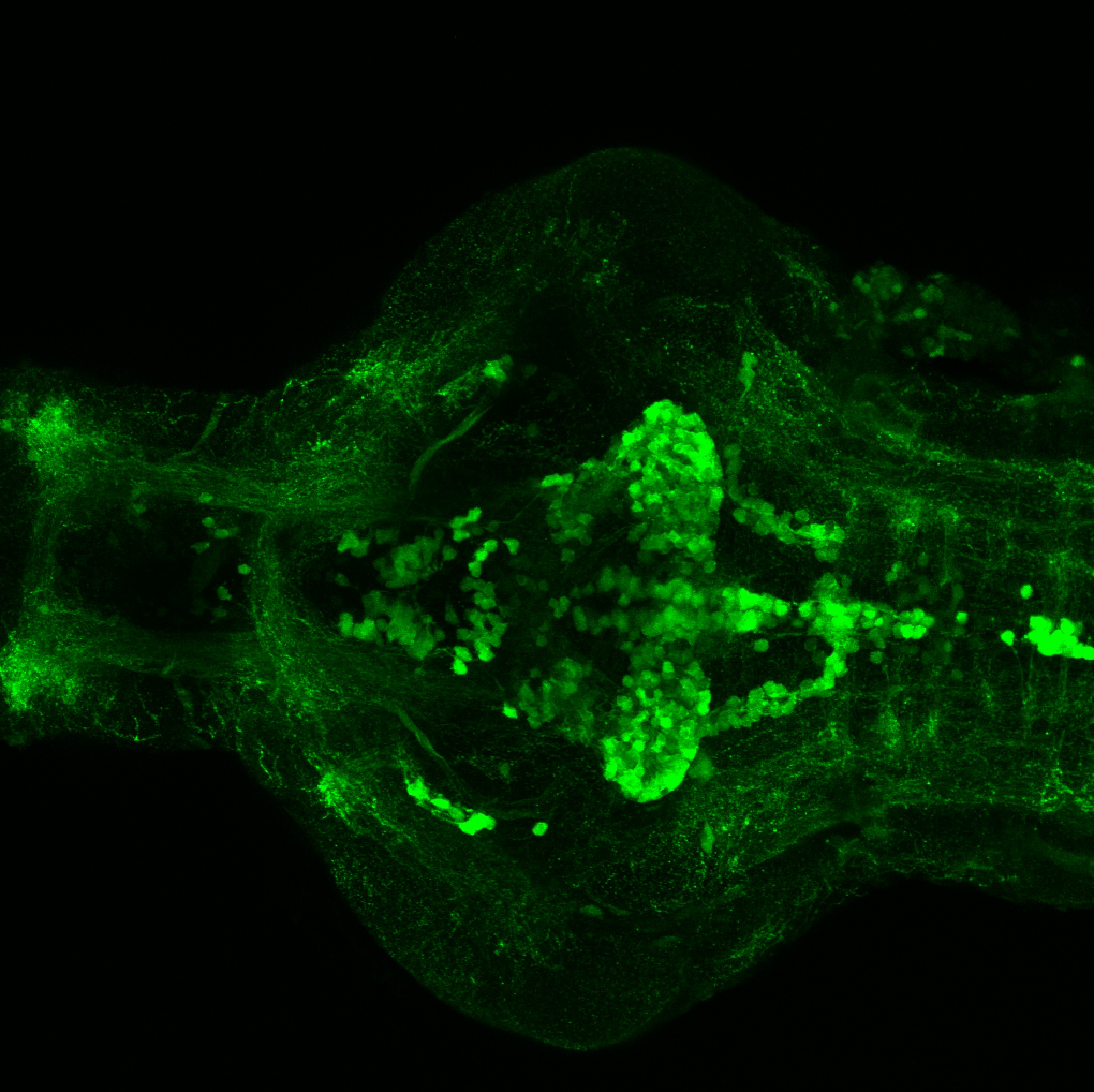 4dpf  Ventral view of ETvmat2:GFP.