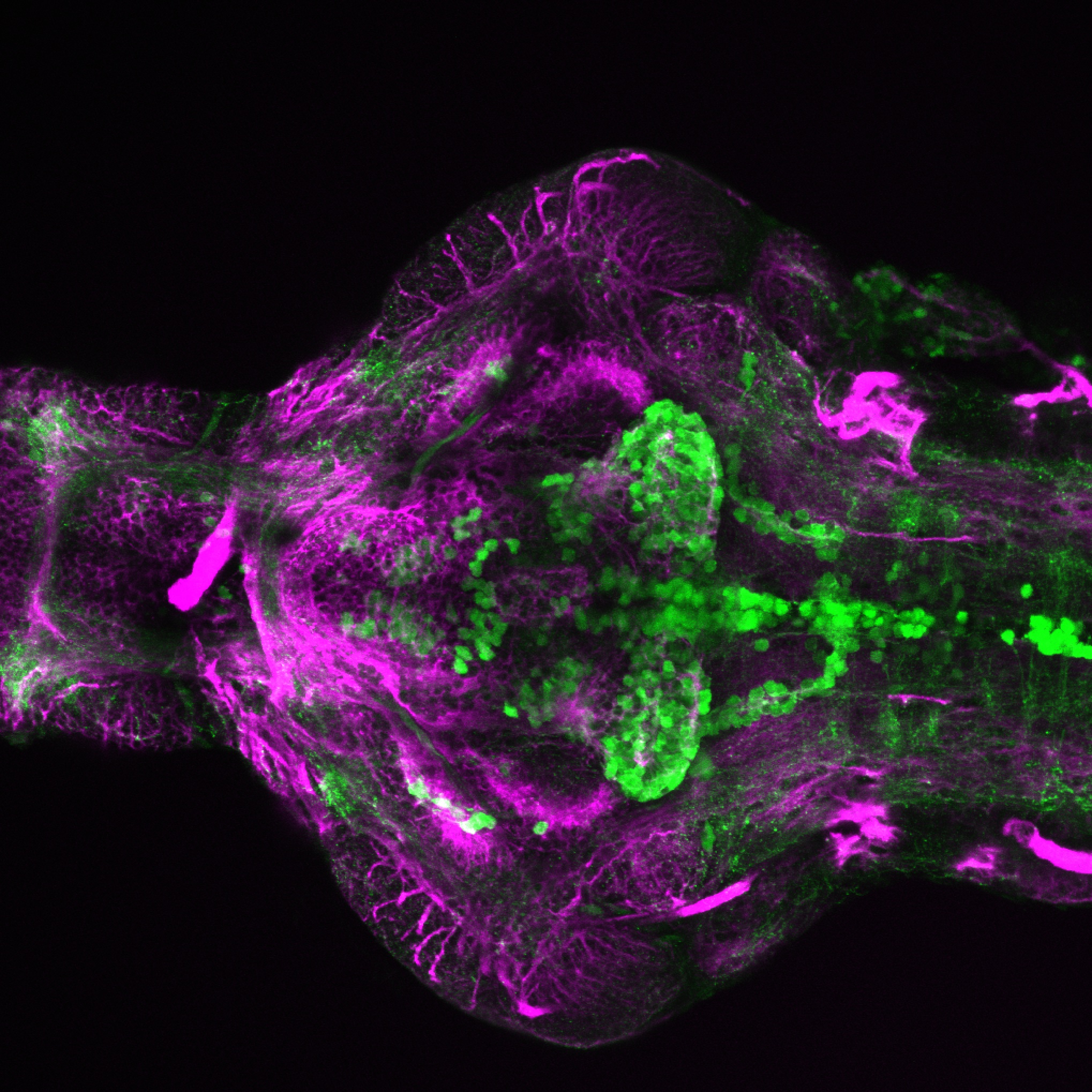 4dpf Ventral view of ETvmat2:GFP with acetylated tubulin(magenta).. 