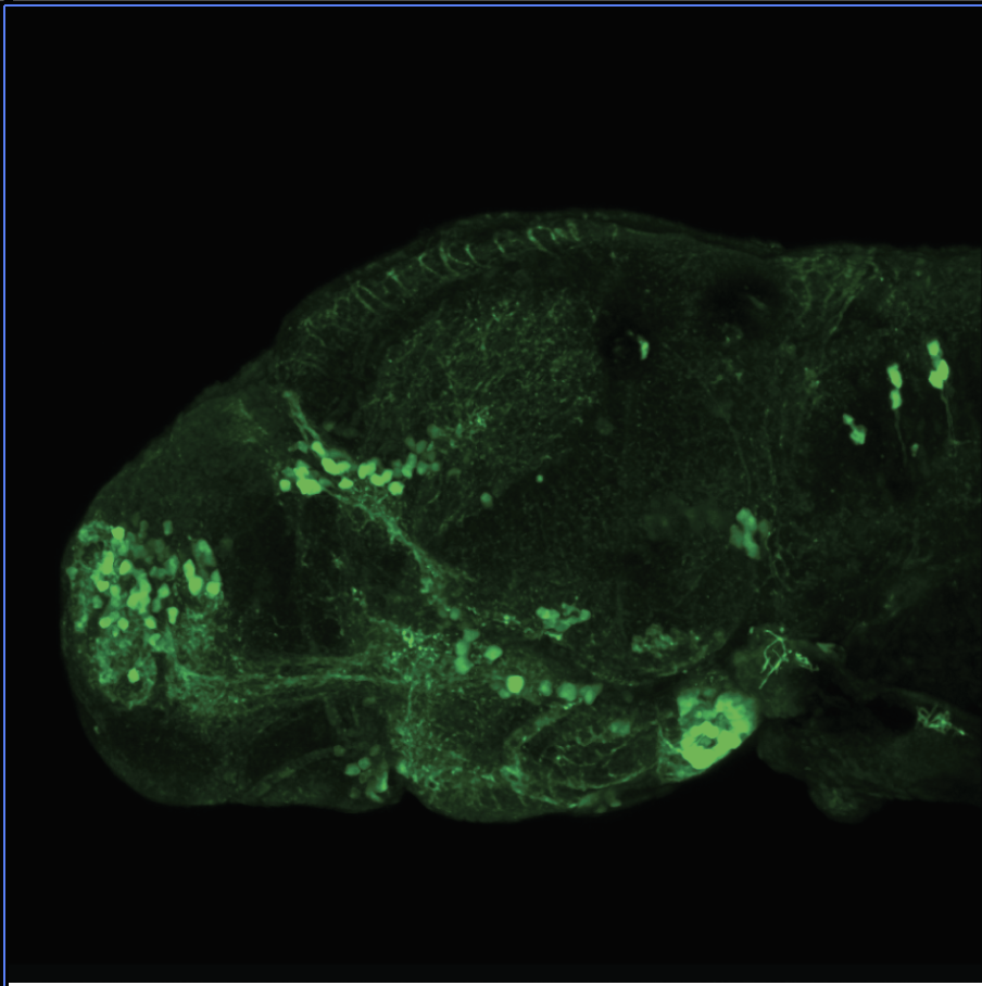 4dpf Lateral view of ETvmat2:GFP  