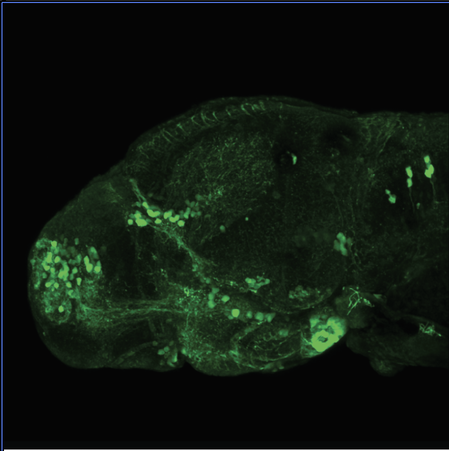 4dpf Lateral view of ETvmat2:GFP