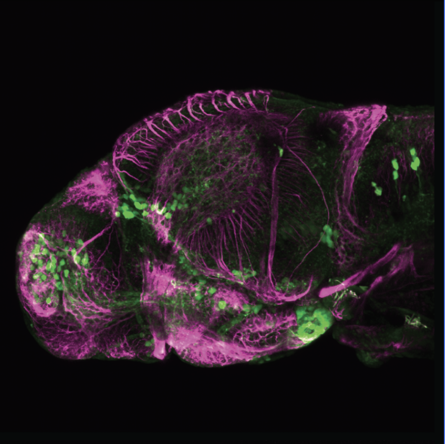 4dpf Lateral view of ETvmat2:GFP with acetylated tubulin(magenta). 