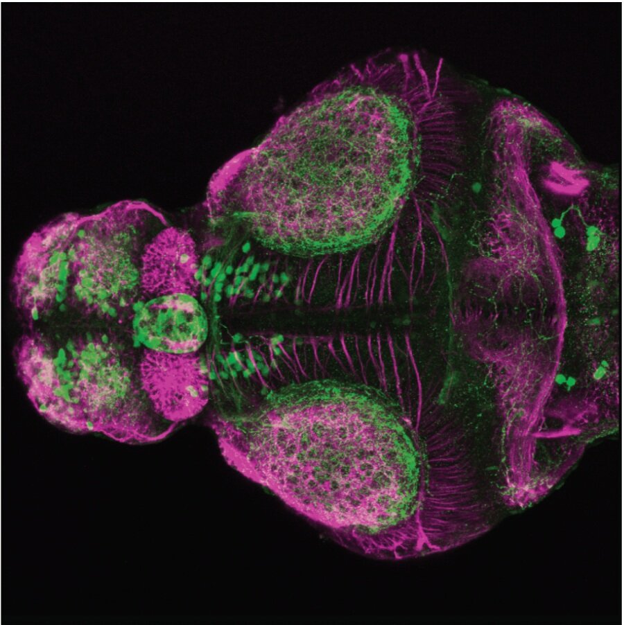 4dpf dorsal view of ETvmat2:GFP with acetylated tubulin(magenta). 