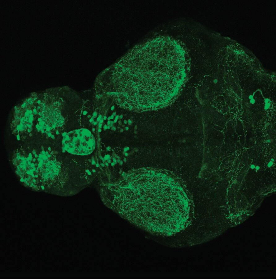 4dpf dorsal view of ETvmat2:GFP. 