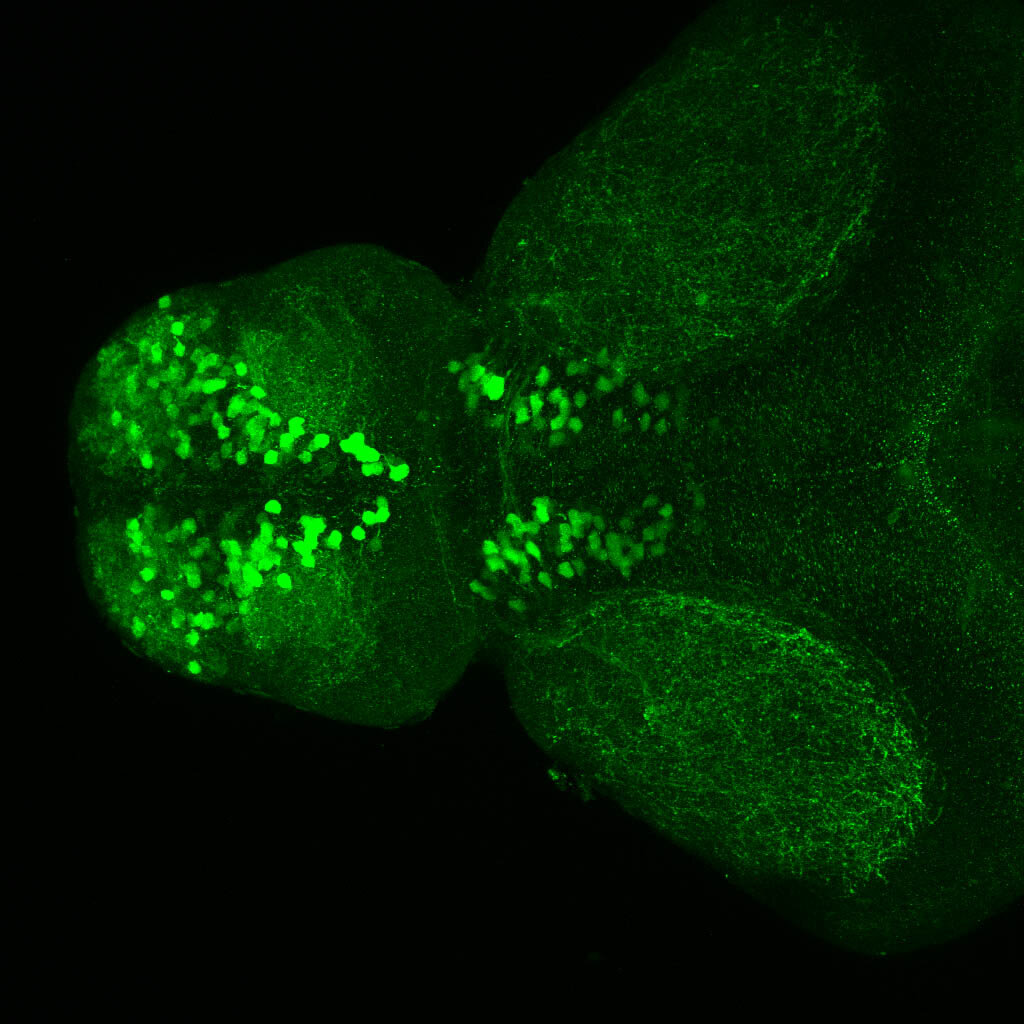 5dpf dorsal view of ETvmat2:GFP forebrain.