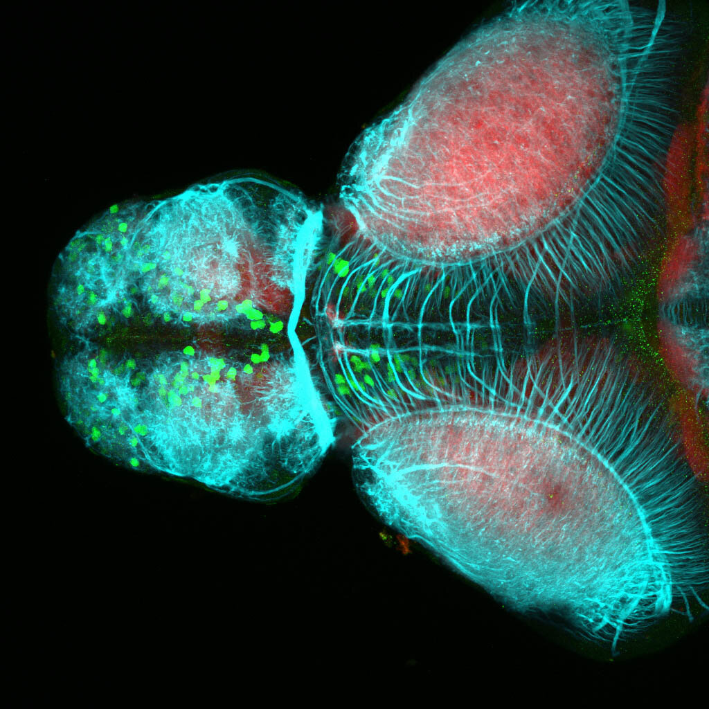 5dpf dorsal view of ETvmat2:GFP forbrain with acetylated tubulin(cyan) and SV2(red). 