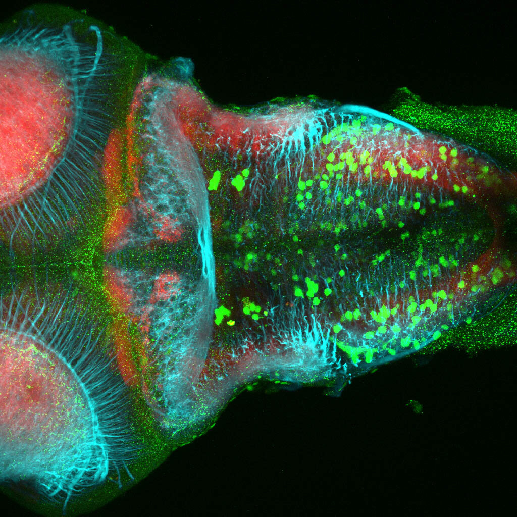 dpf dorsal view of ETvmat2:GFP hindbrain with acetylated tubulin(cyan) and SV2(red). 