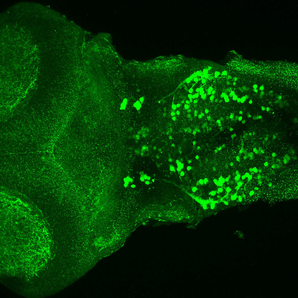 5dpf dorsal view of ETvmat2:GFP hindbrain.