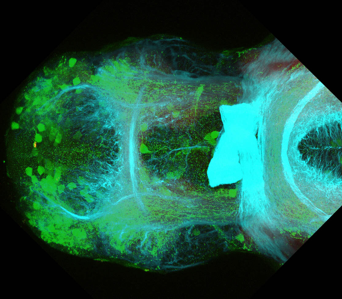 5dpf  Ventral view of ETvmat2:GFP forebrain with acetylated tubulin(cyan).