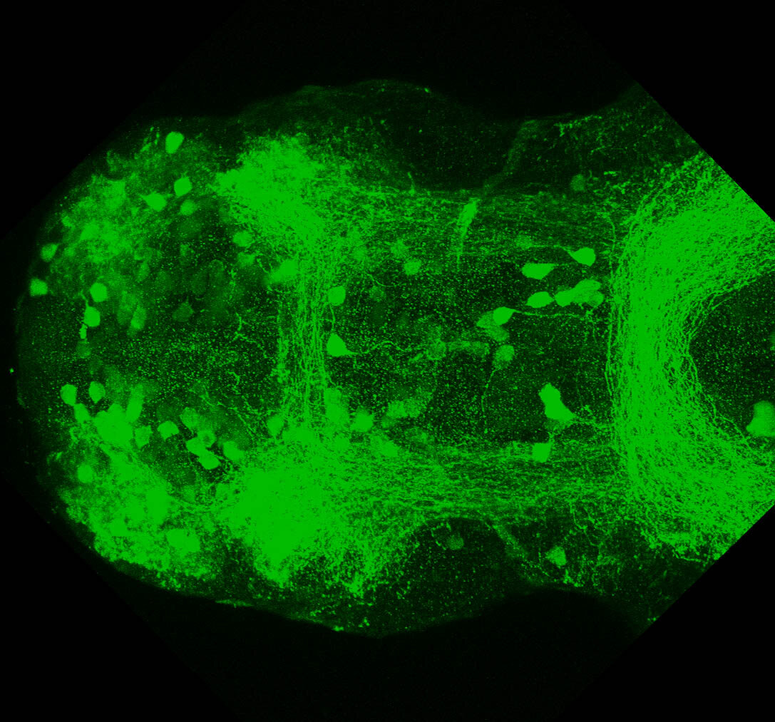 5dpf  Ventral view of ETvmat2:GFP forebrain.