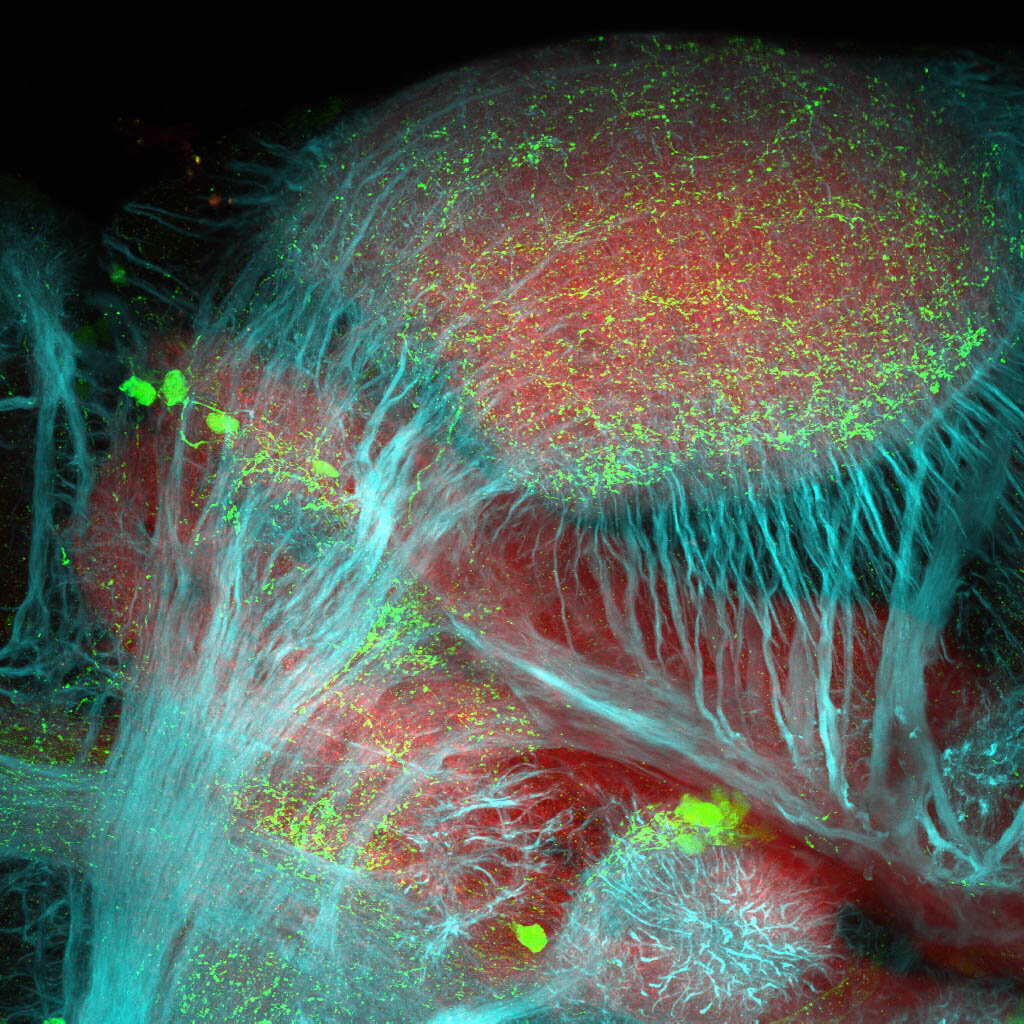 5dpf Lateral view of ETvmat2:GFP diencephalon with acetylated tubulin(cyan) and SV2(red). 