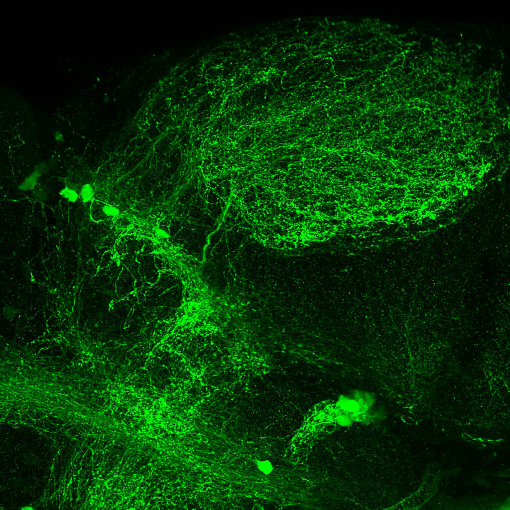 5dpf Lateral view of ETvmat2:GFP diencephalon