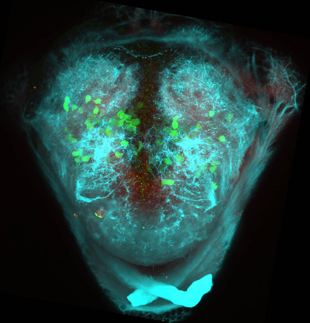 5dpf Frontal view of ETvmat2:GFP with acetylated tubulin(cyan) and SV2(red). 