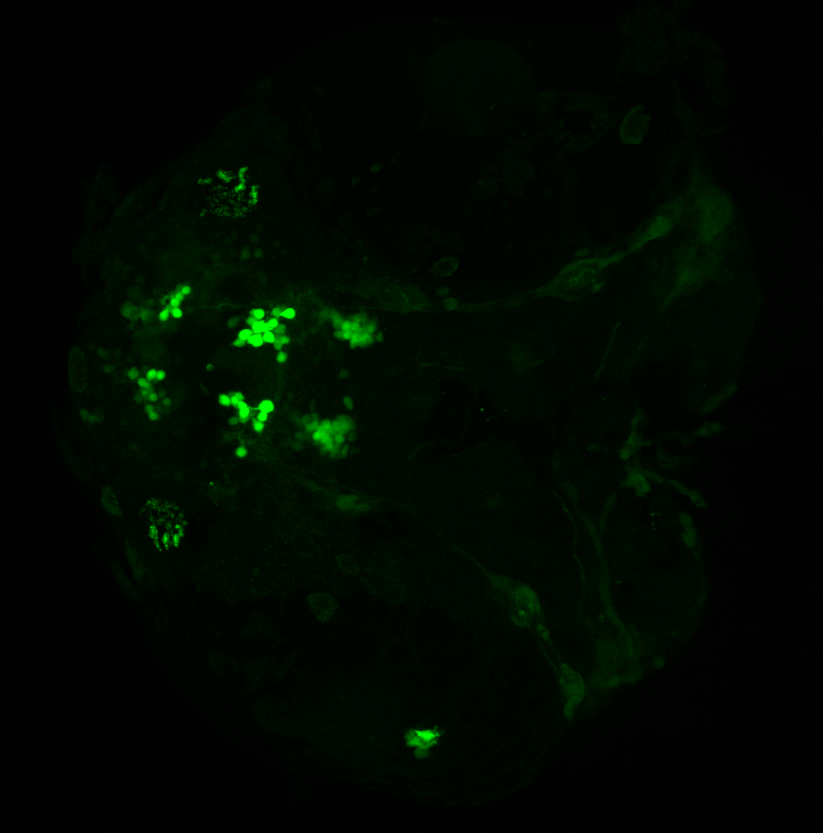 xeom:GFP 60hpf ventral