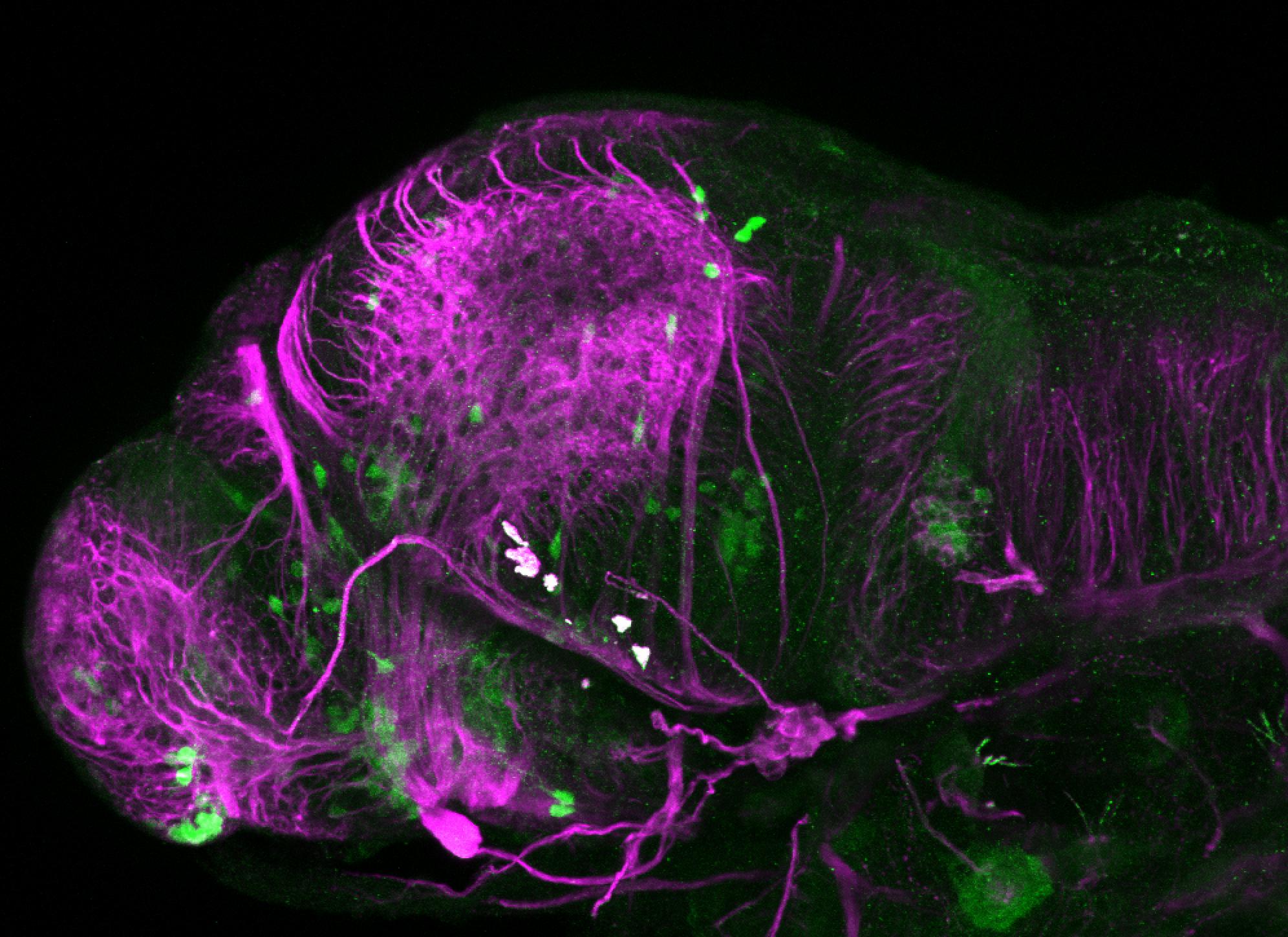 xeom:GFP 3dpf lateral and tubulin (magenta)