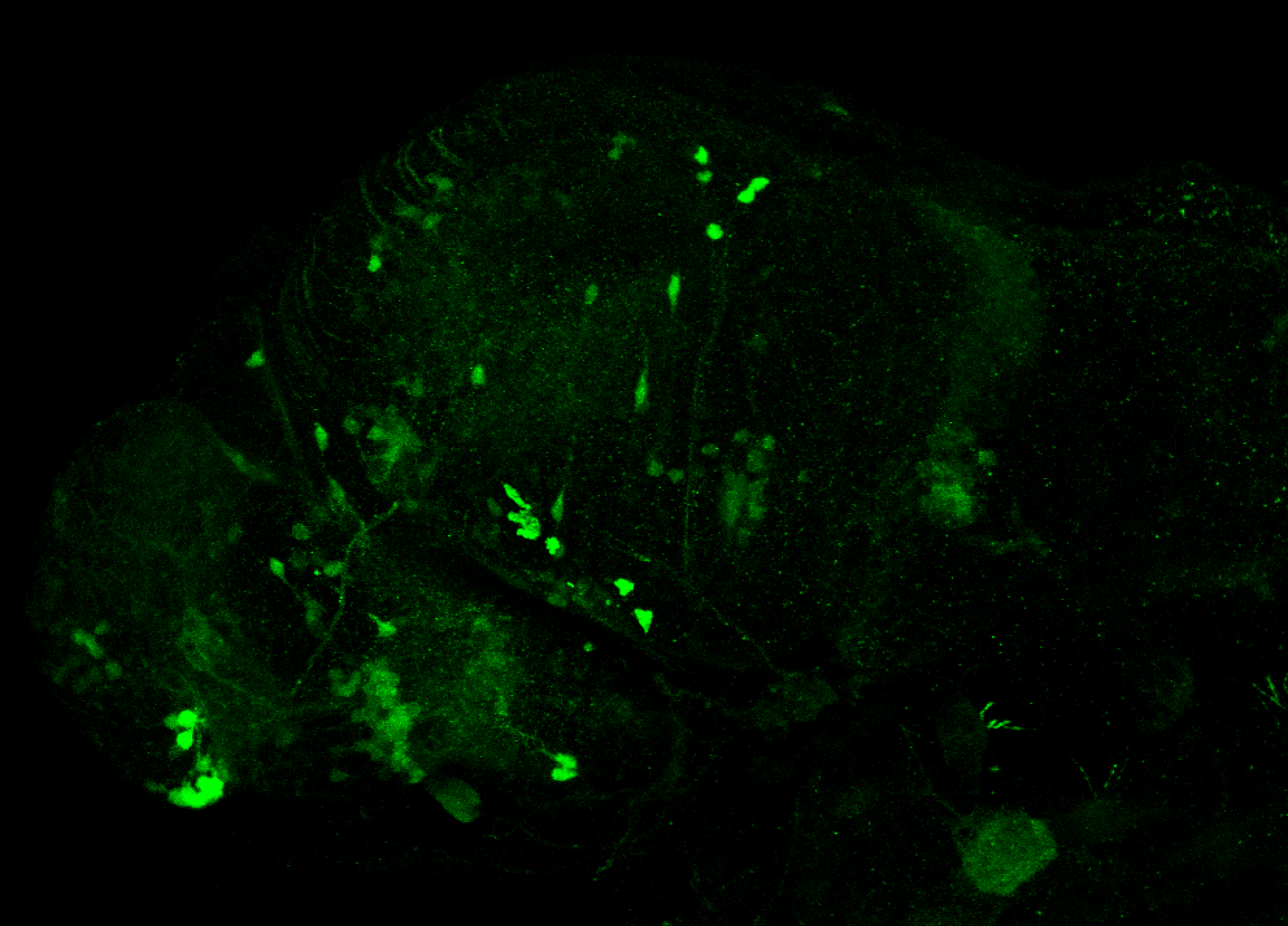 xeom:GFP 3dpf lateral