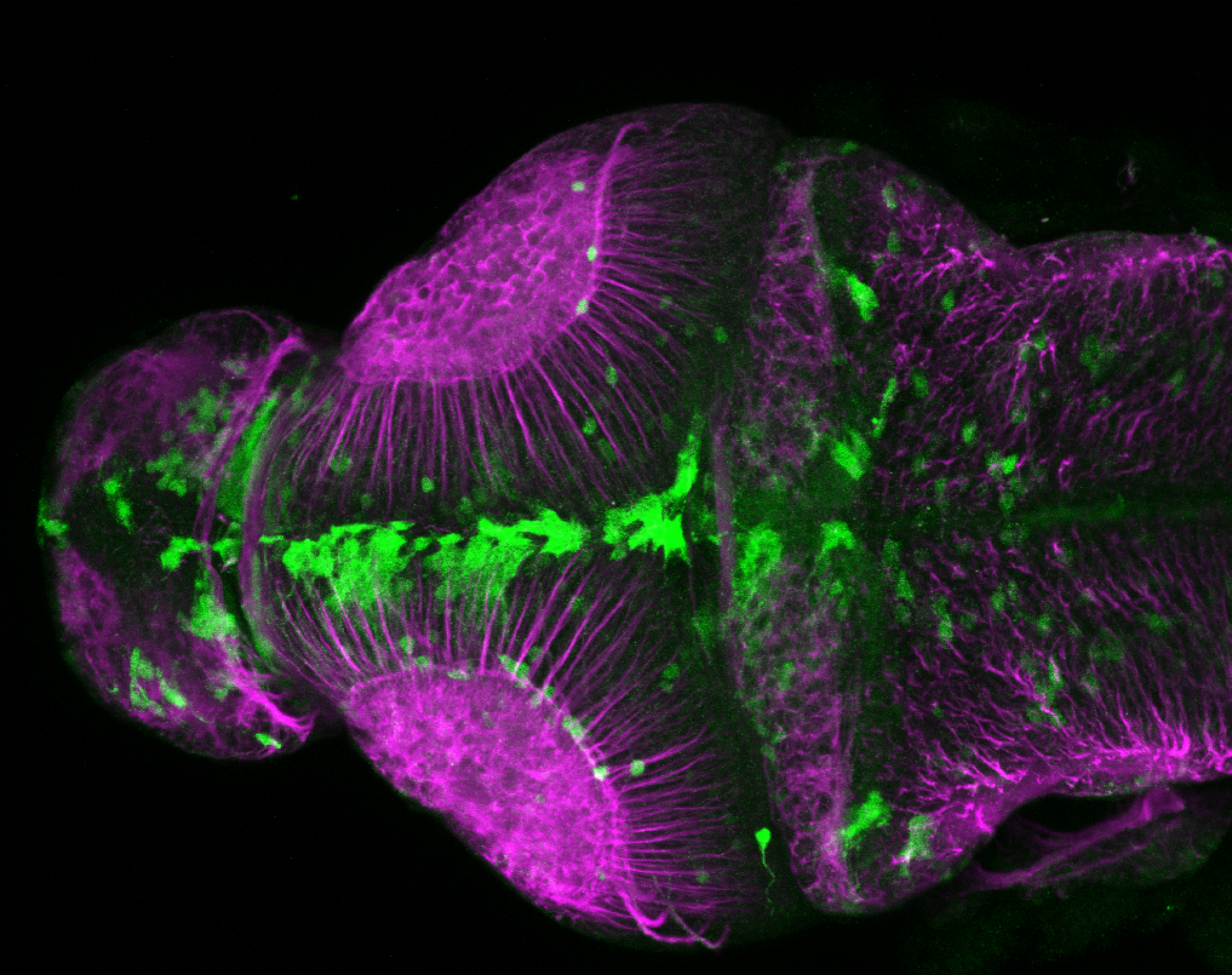 xeom:GFP 3dpf dorsal with tubulin(magenta)