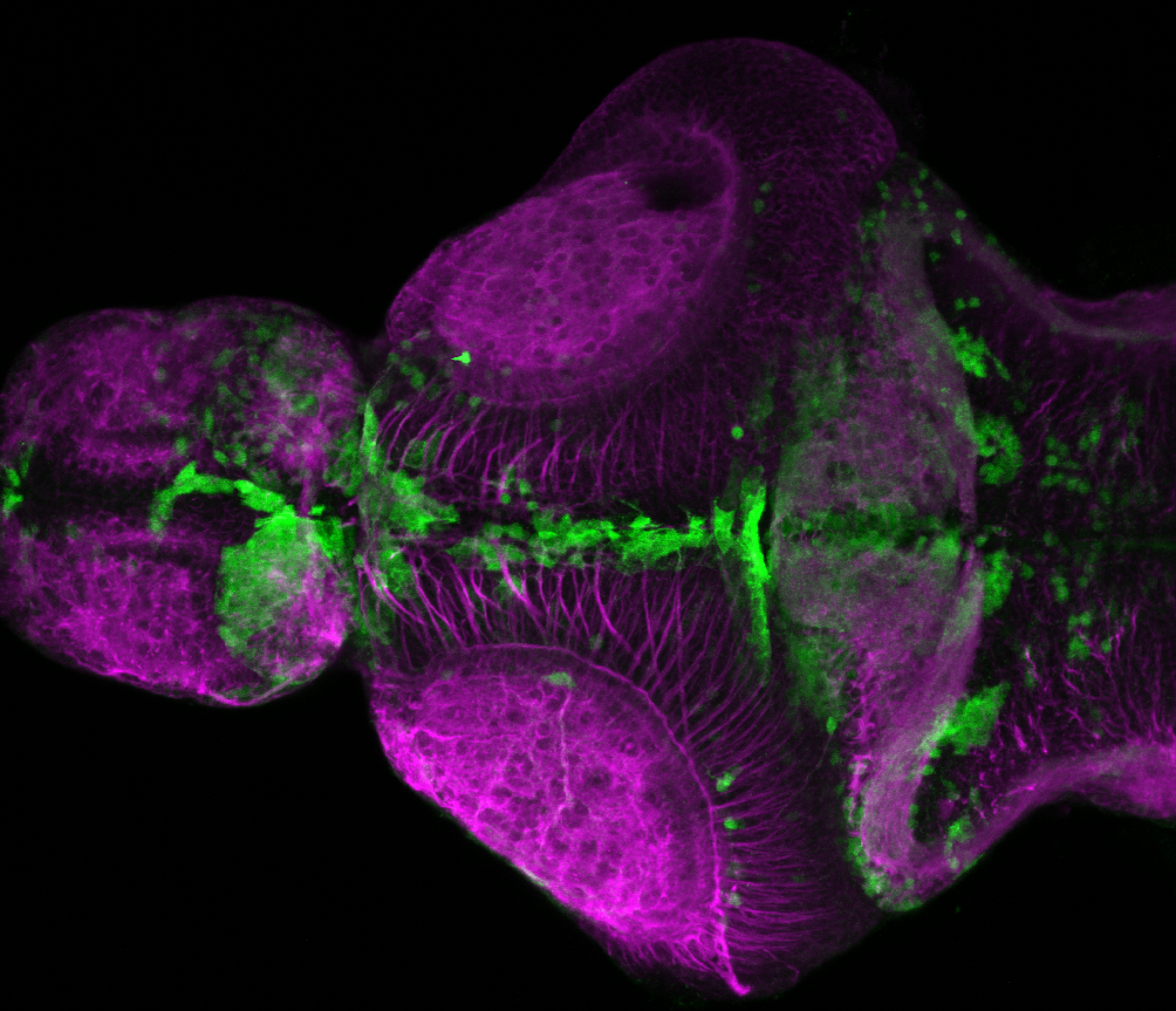 xeom:GFP 5dpf dorsal with tubulin(magenta)