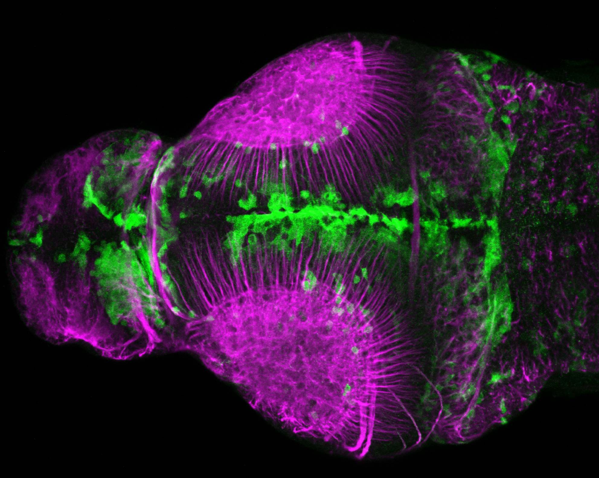 xeom:GFP 3dpf dorsal with tubulin(magenta)