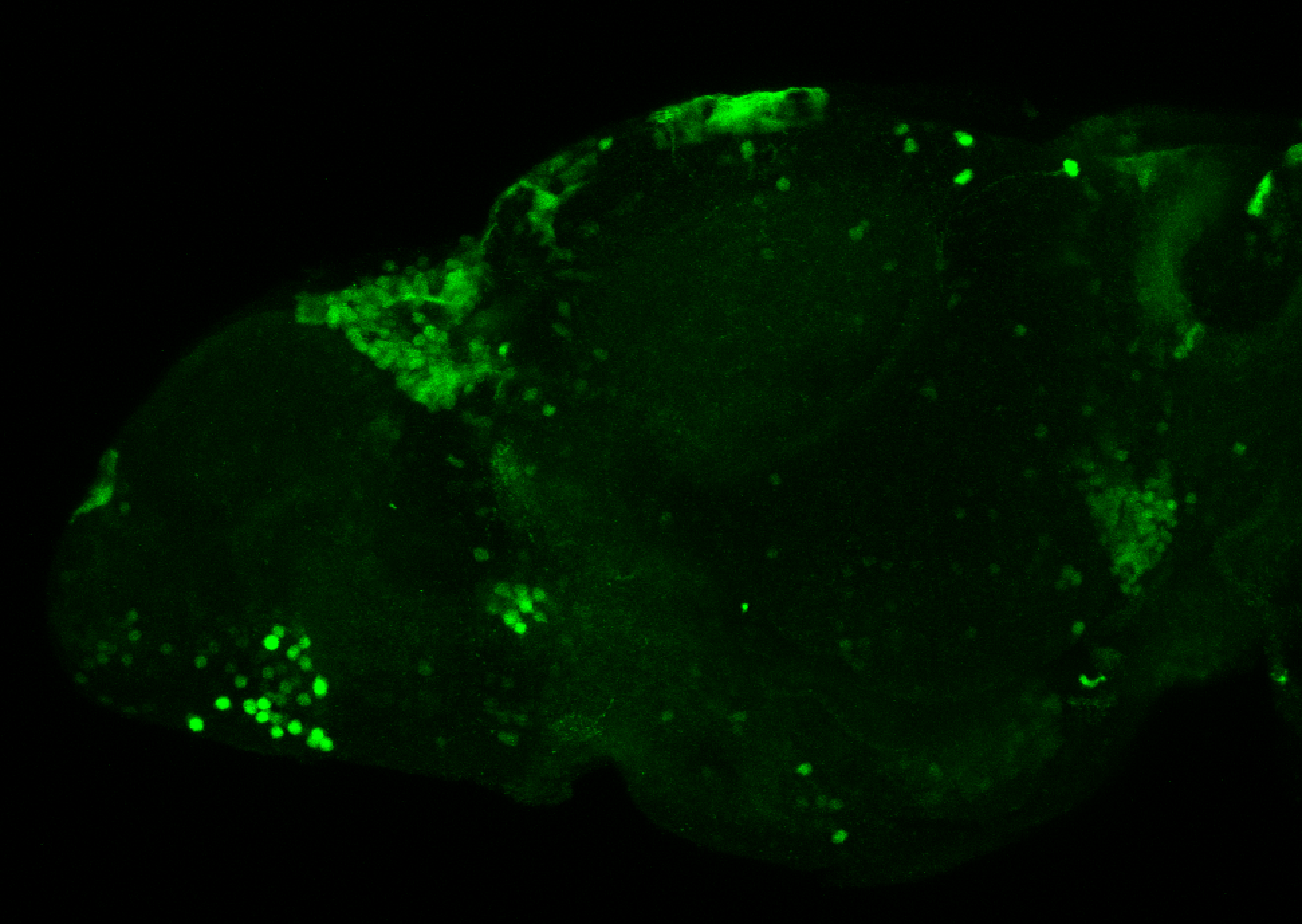 xeom:GFP 5dpf lateral