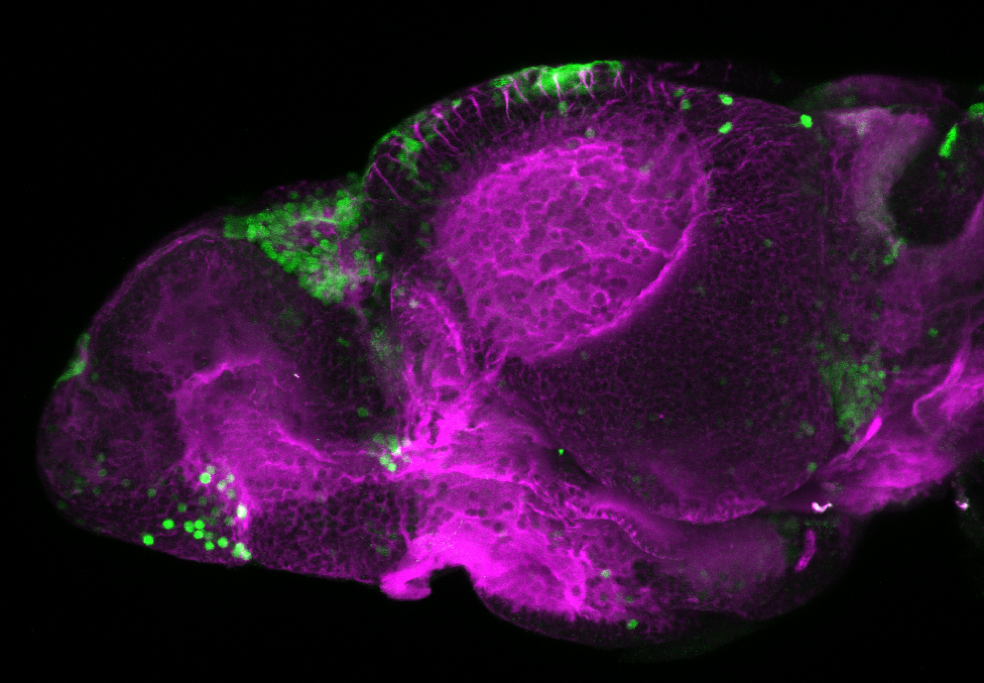 xeom:GFP 5dpf lateral with tubulin (magenta)