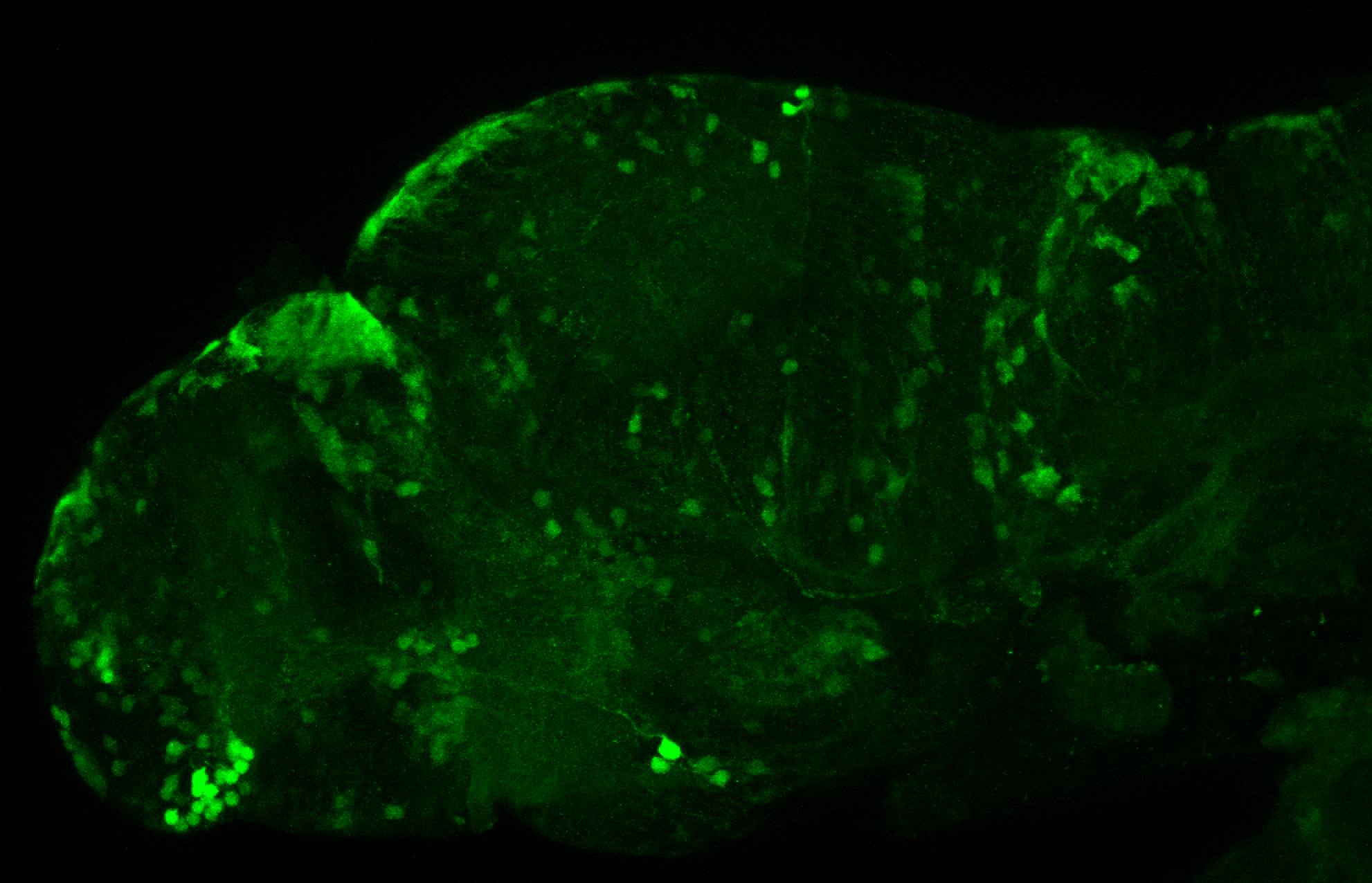 xeom:GFP 3dpf lateral