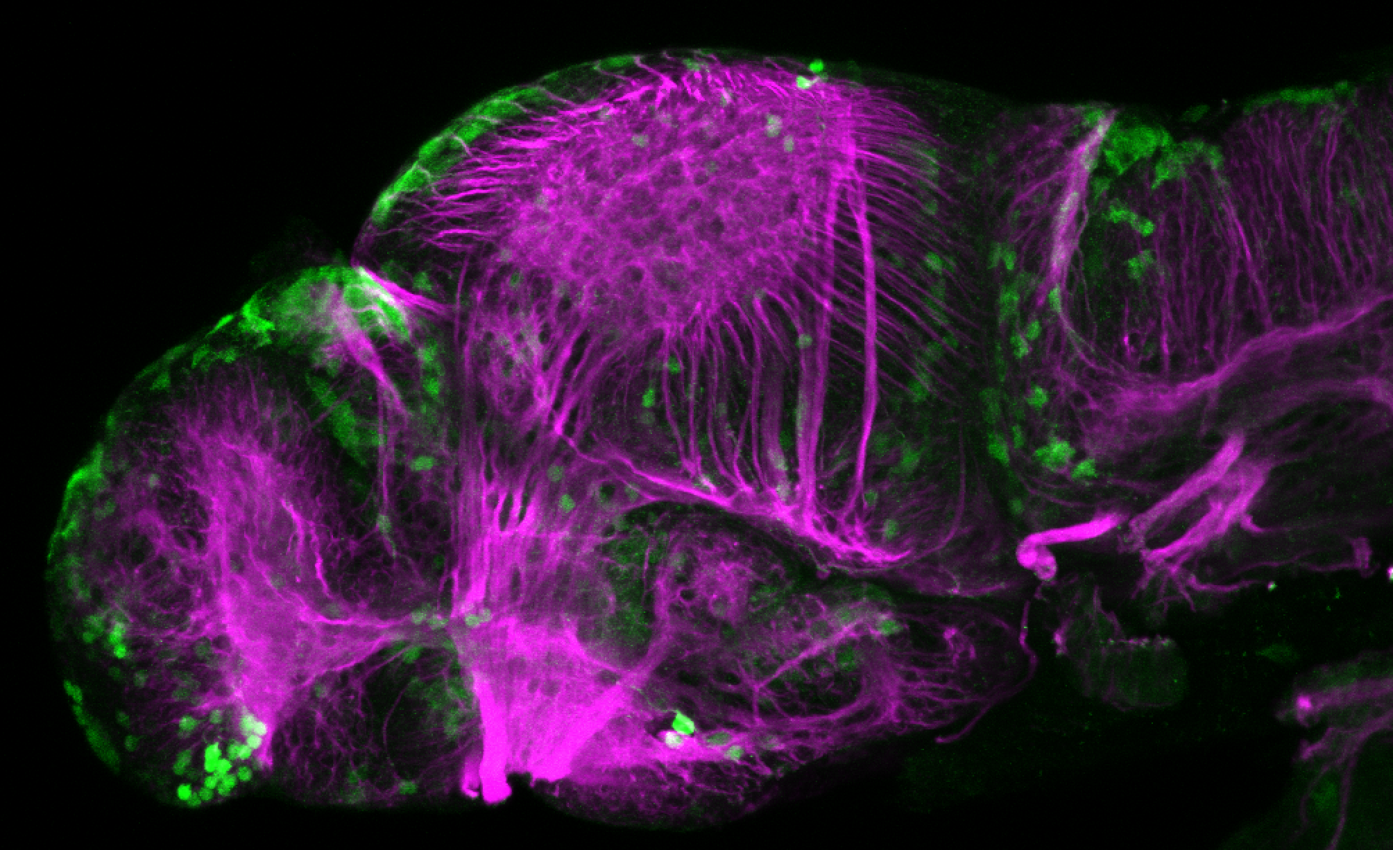 xeom:GFP 3dpf lateral with tubulin (magenta)