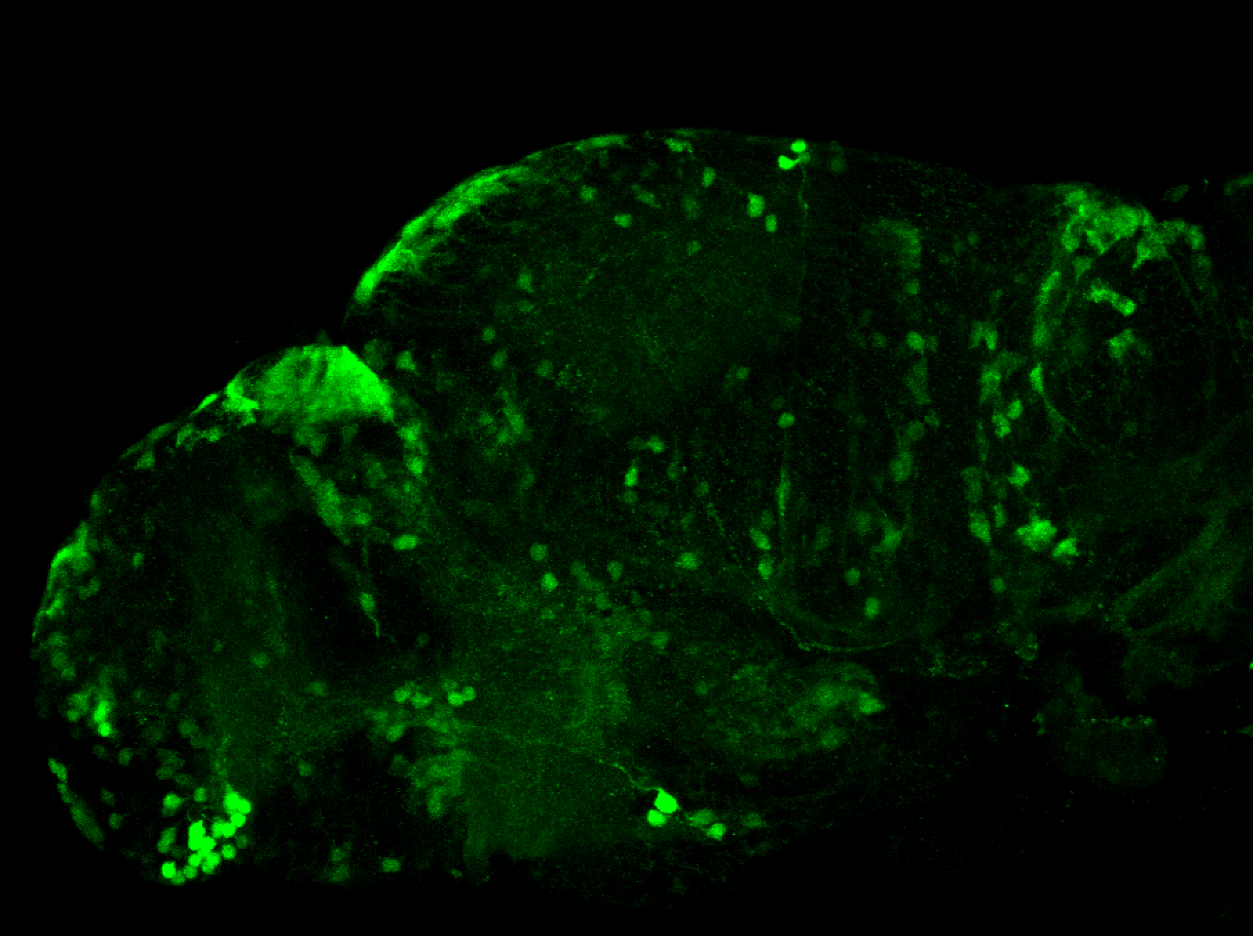 xeom:GFP 3dpf lateral 