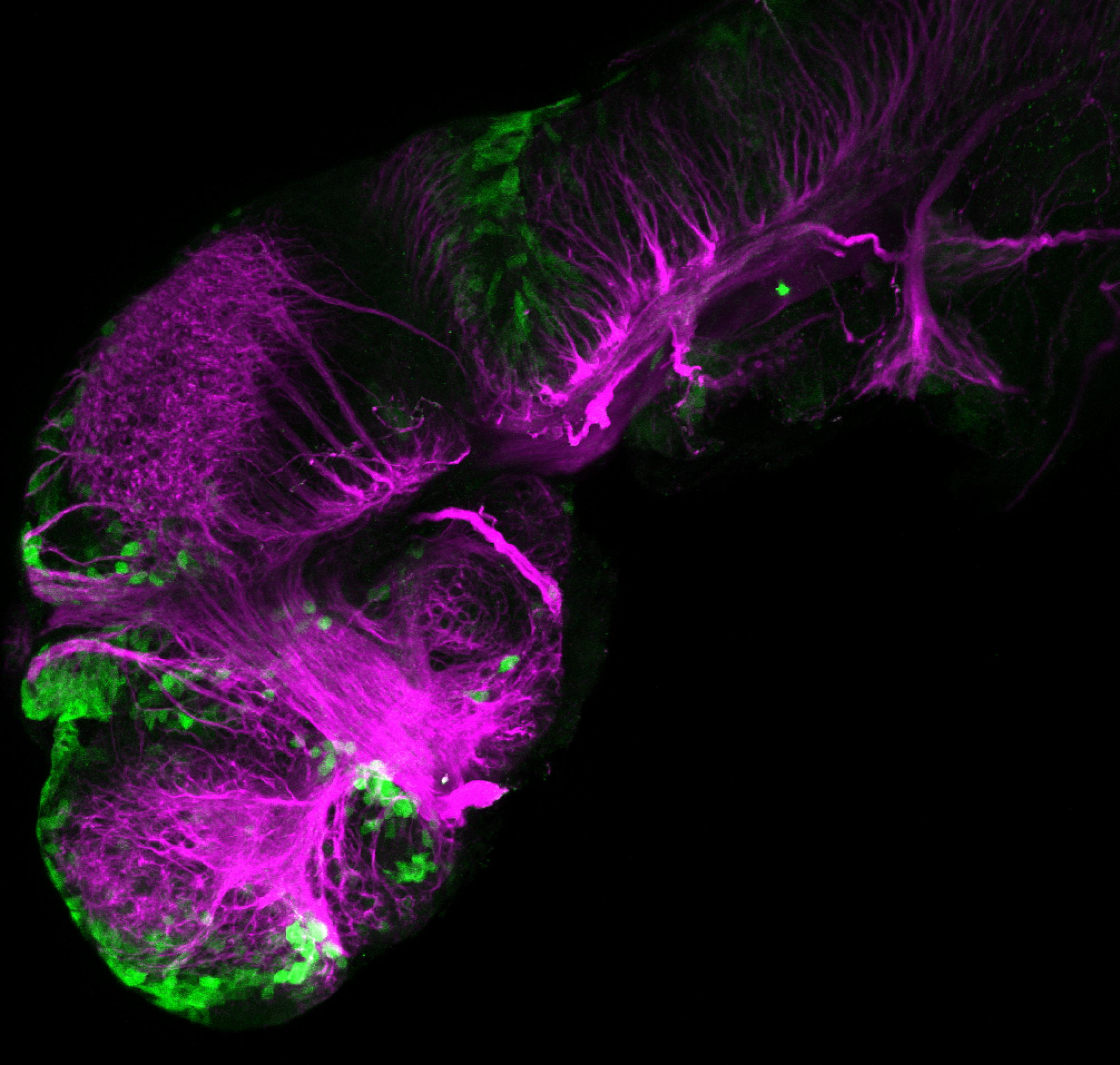 xeom:GFP 2dpf lateral with tubulin (magenta)