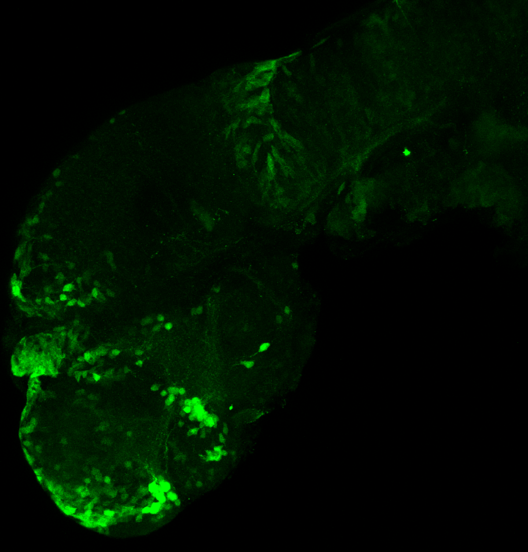 xeom:GFP 2dpf lateral 