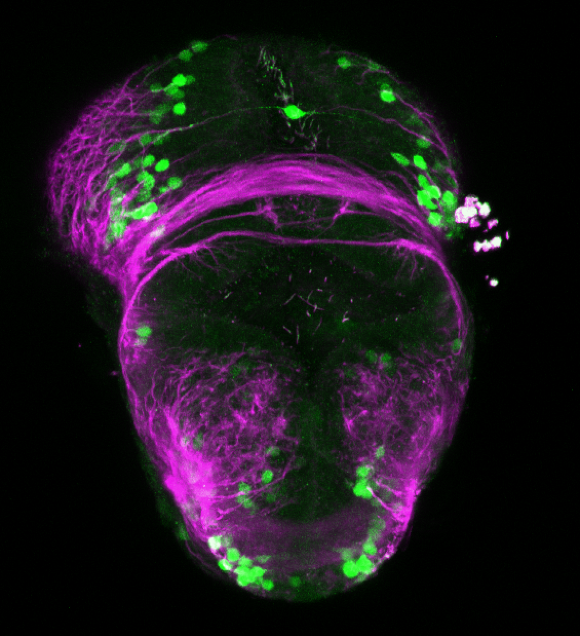 xeom:GFP 2dpf frontal with tubulin (magenta)