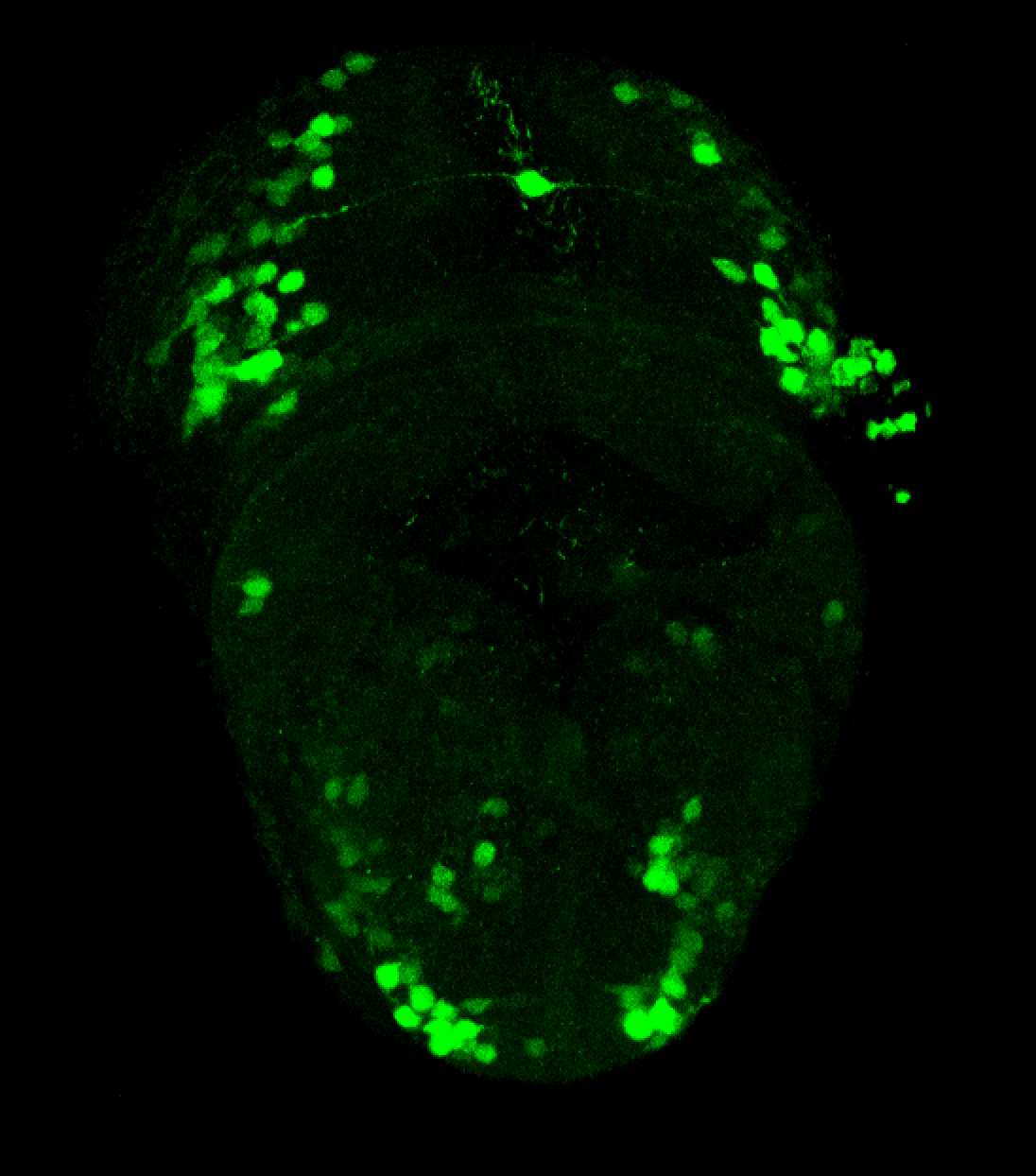 xeom:GFP 2dpf frontal