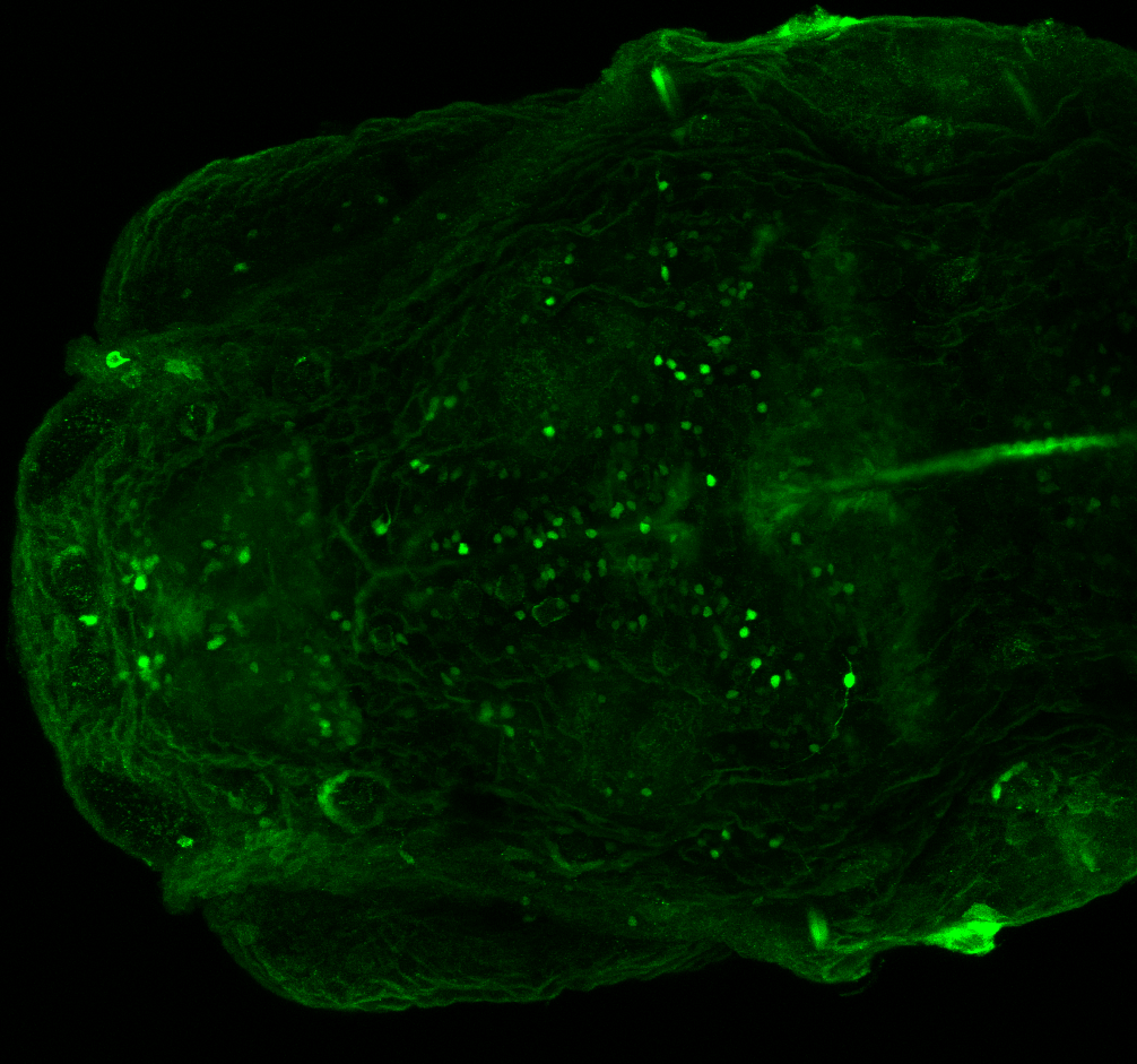 xeom:GFP 40dpf dorsal