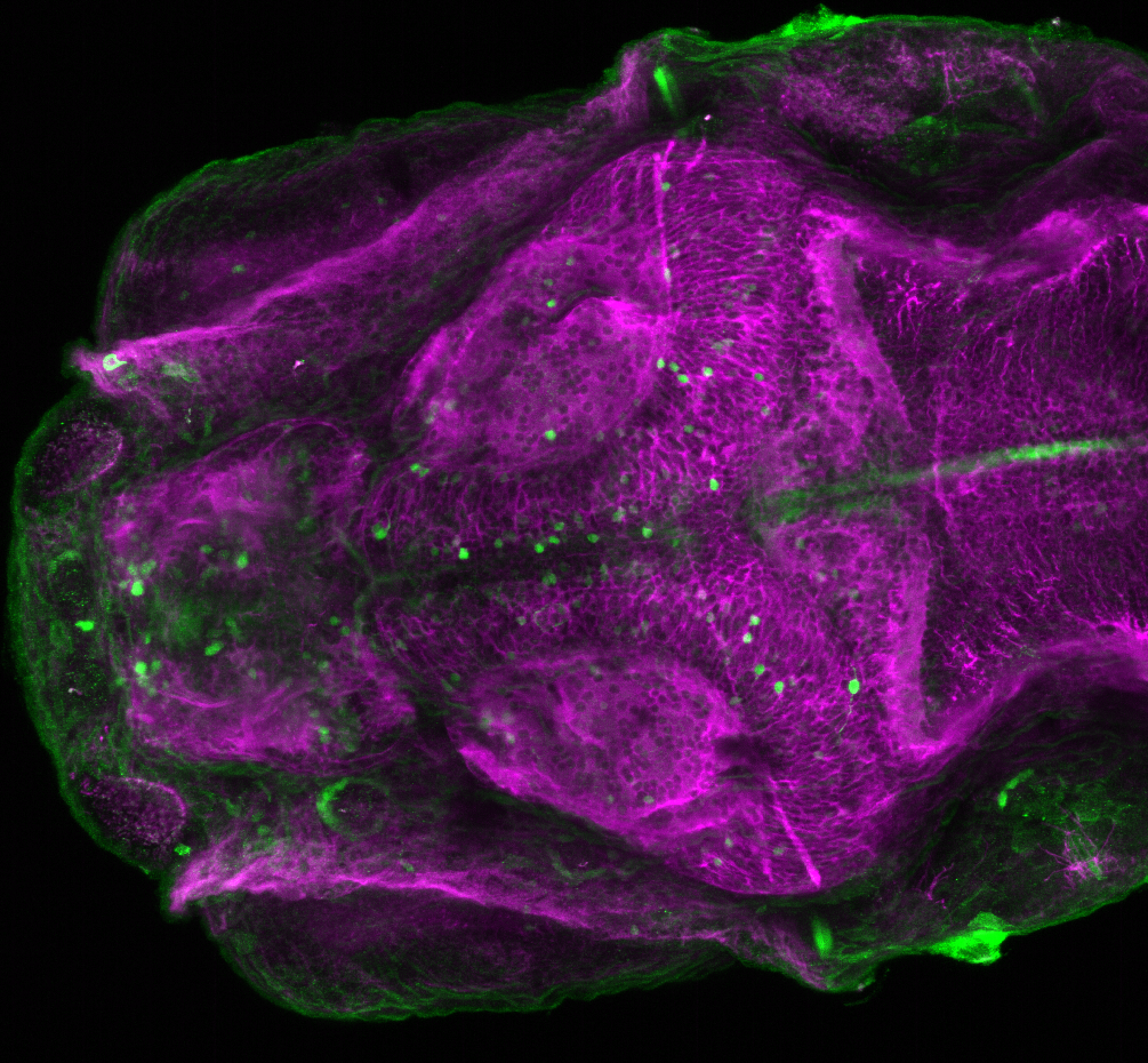 xeom:GFP 4dpf dorsal with tubulin(magenta).