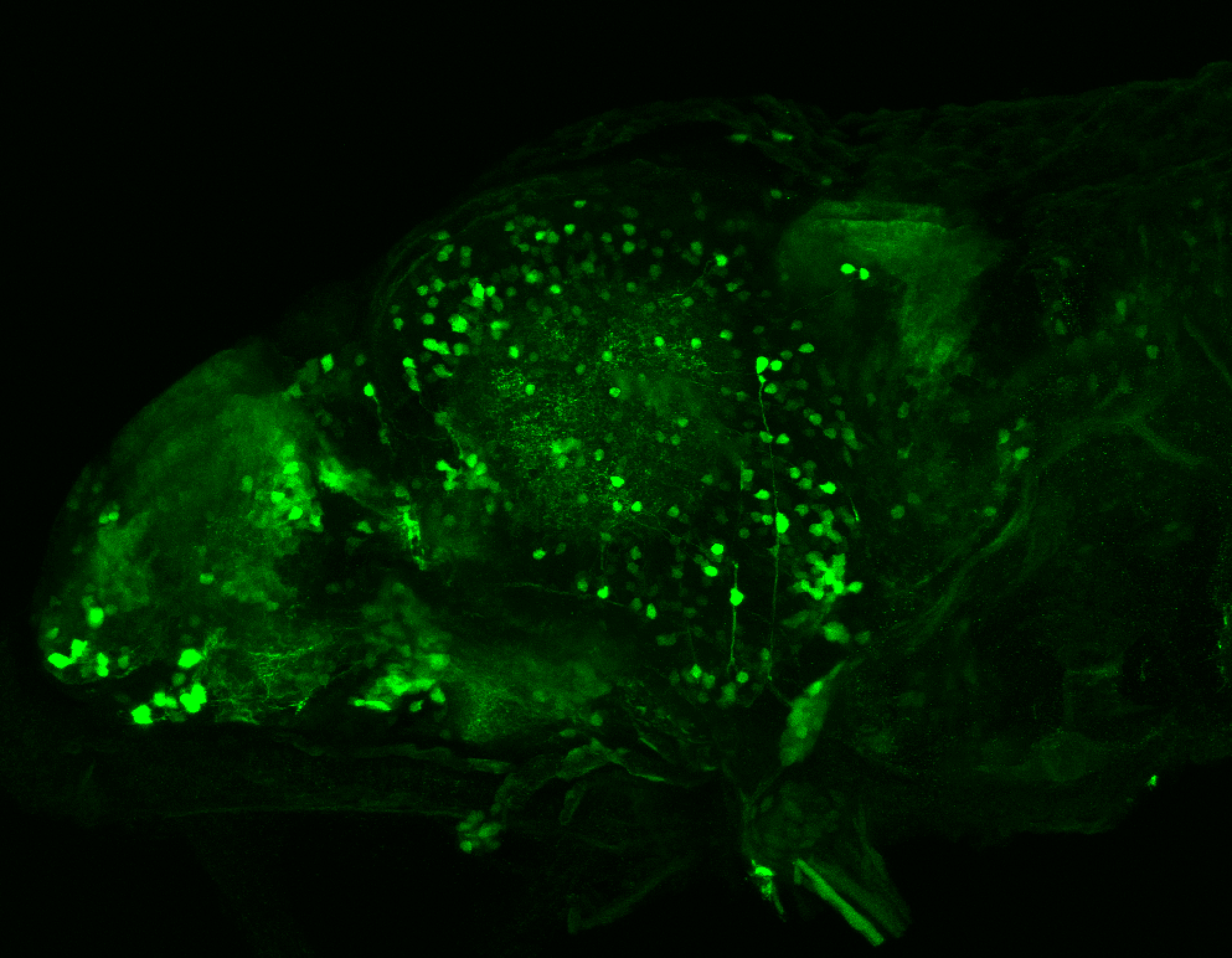 xeom:GFP 4dpf lateral