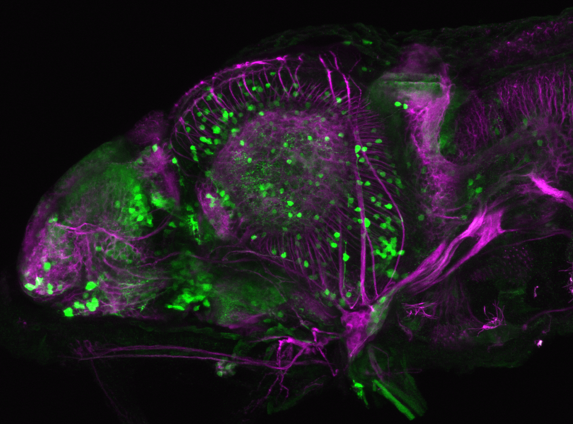 xeom:GFP 4dpf lateral with tubulin(magenta)