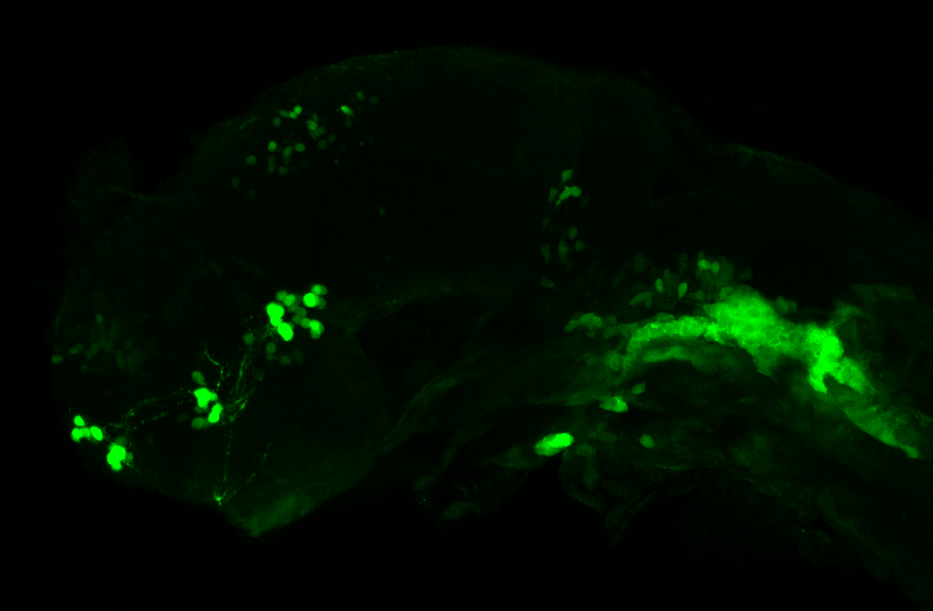 xeom:GFP 36hpf lateral 
