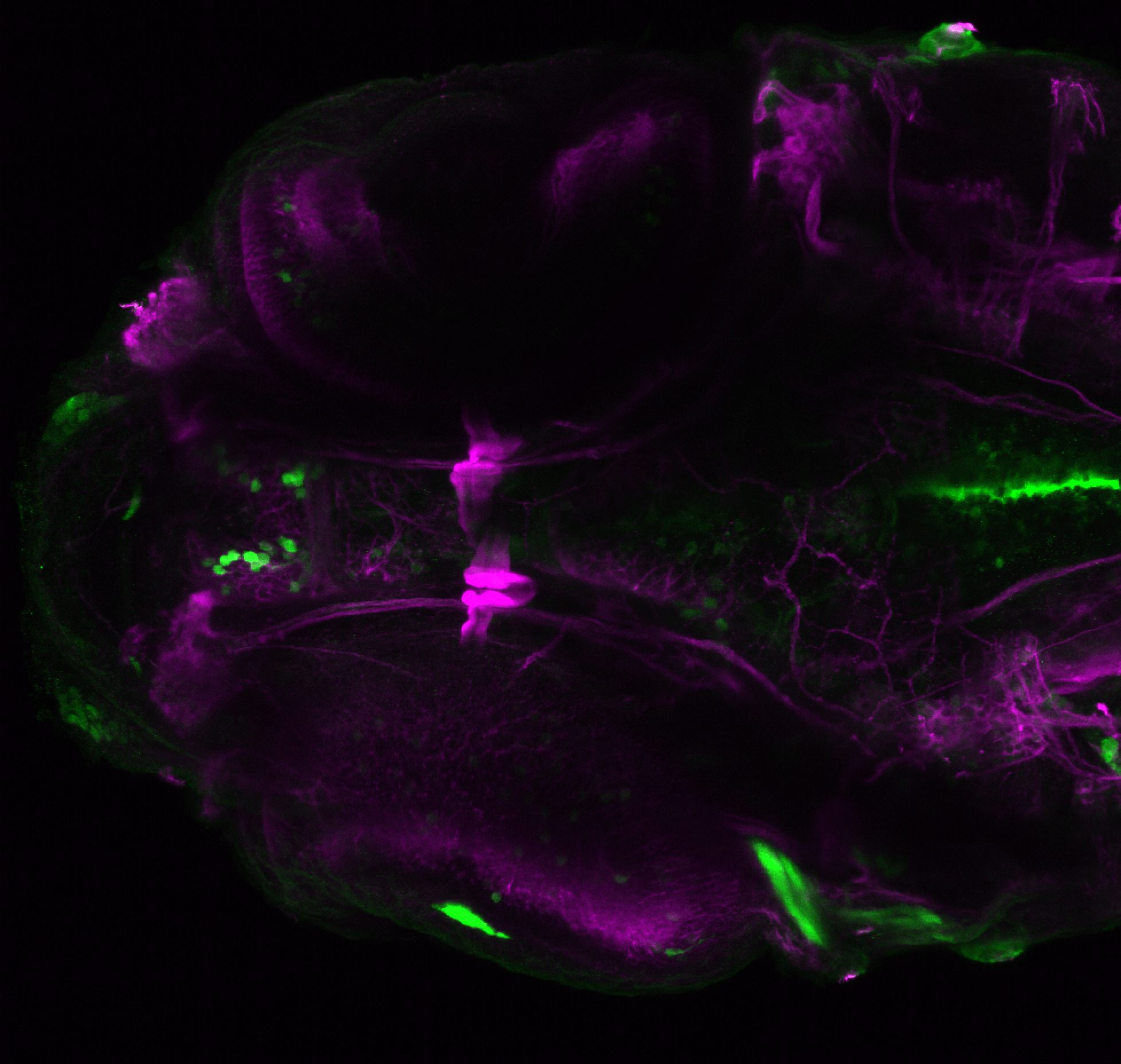 xeom:GFP 4dpf ventral with tubulin(magenta).