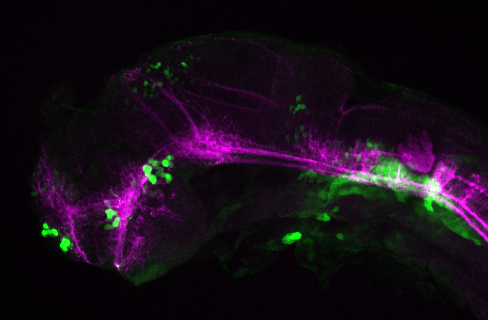 xeom:GFP 36hpf lateral with tubulin(magenta).