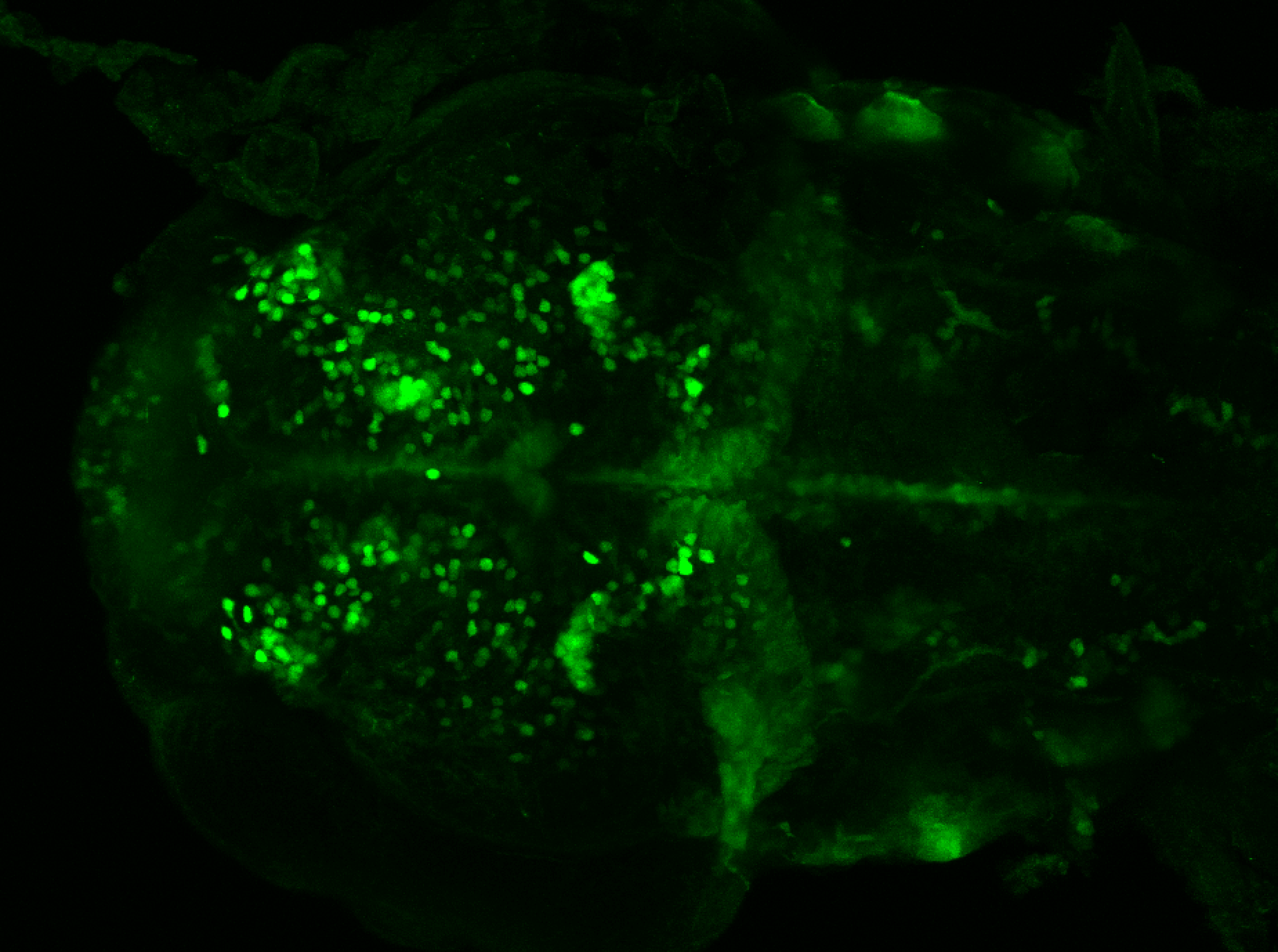 xeom:GFP 60hpf dorsal