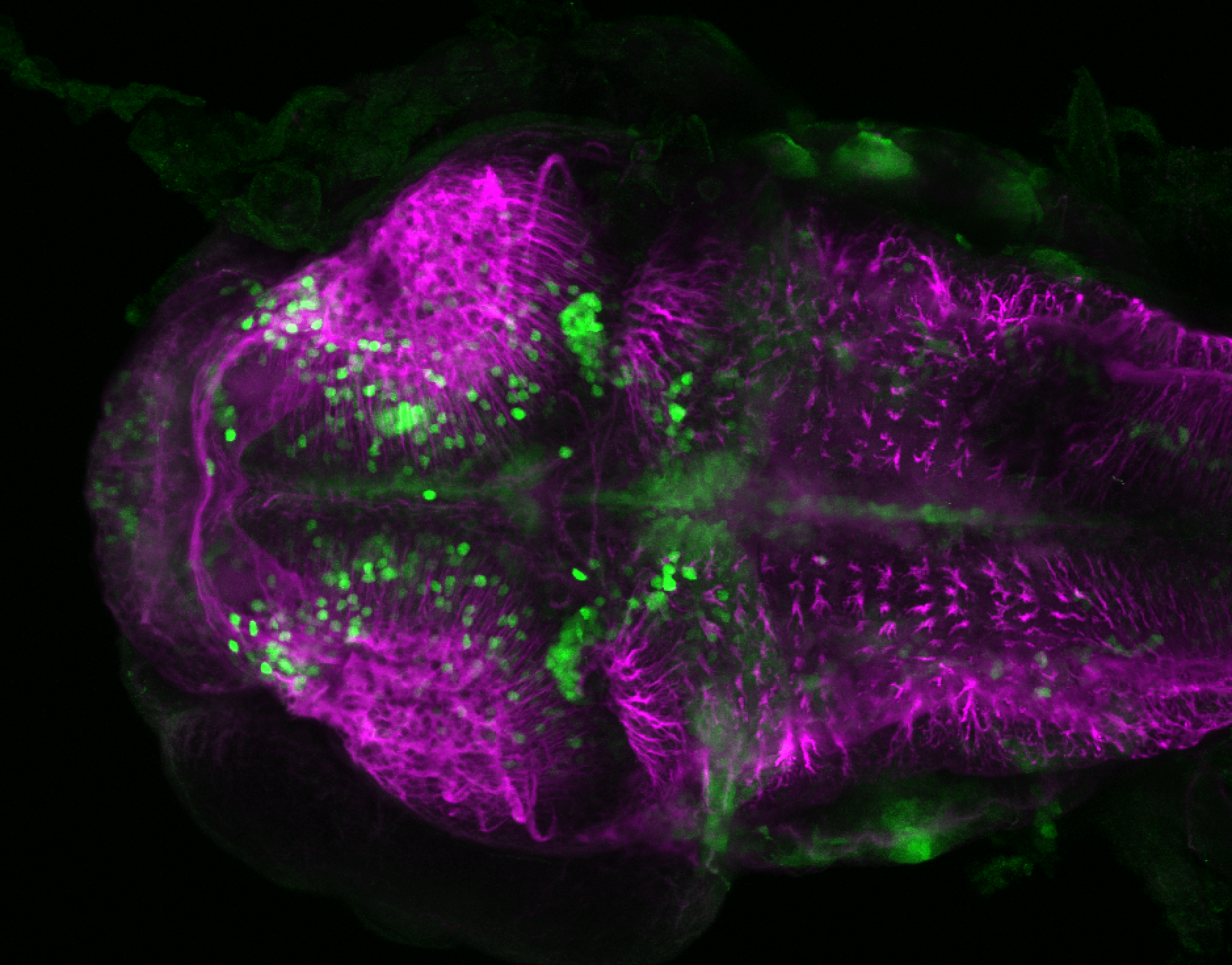 xeom:GFP 60hpf dorsal and tubulin(magenta)