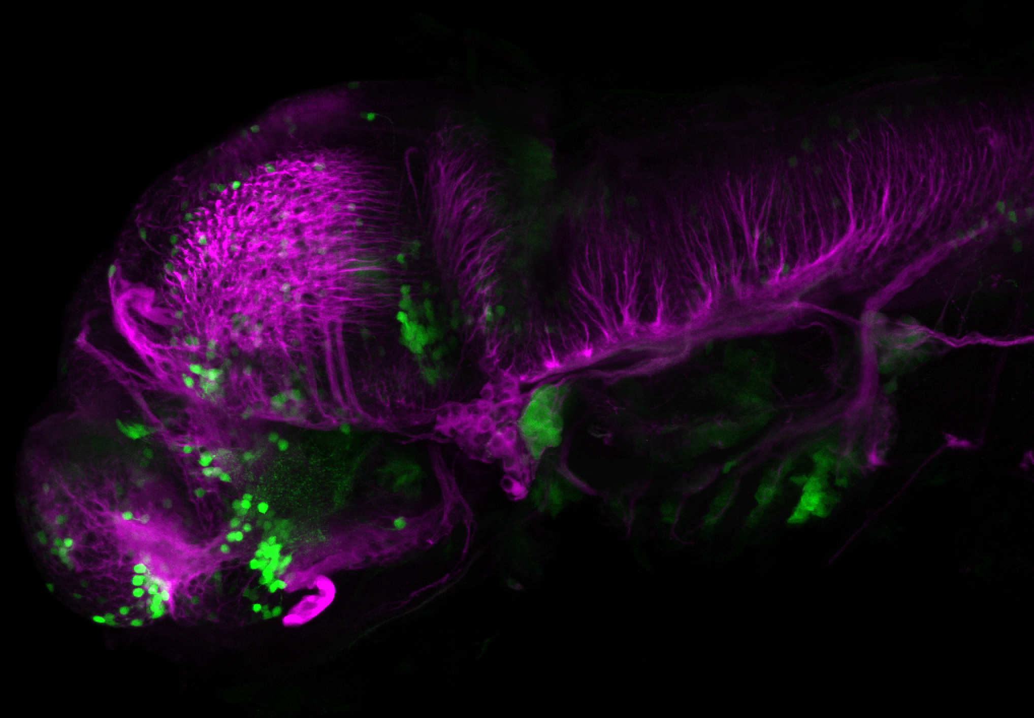 xeom:GFP 60hpf lateral with tubulin(magenta)