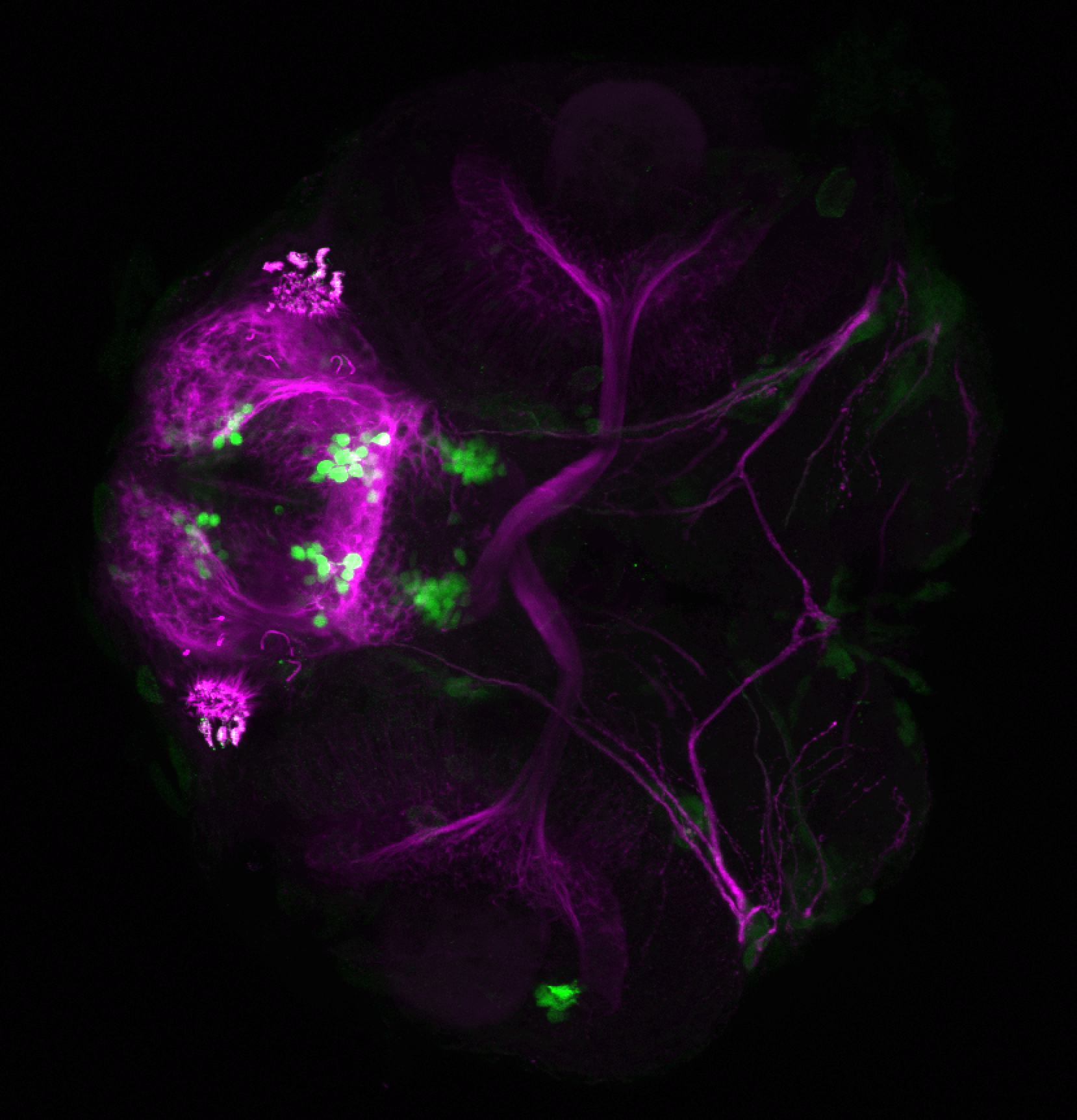 xeom:GFP 60hpf ventral and tubulin(magenta)